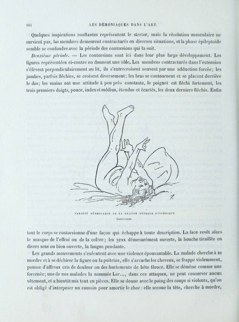 Quelques inspirations ronflantes représentent le stertor, mais la résolution musculaire ne survient pas, les membres demeurent contracturés en diverses situations, et la phase épileptoïde semble se confondre avec la période des contorsions qui la suit. Deuxième période. — Les contorsions sont ici dans leur plus large développement. Les figures représentées ci-contre en donnent une idée. Les membres contracturés dans l’extension s’élèvent perpendiculairement au lit, ils s’entrecroisent souvent par une adduction forcée ; les jambes, parfois fléchies, se croisent diversement; les bras se contournent et se placent derrière le dos; les mains ont une attitude à peu près constante, le poignet est fléchi fortement, les trois premiers doigts, pouce, indexetmédius, étendus et écartés, les deux derniers fléchis. Enfin VARIÉTÉ DÉMONIAQUE DE LA GRANDE ATTAQUE HYSTÉRIQUE Contorsions. tout le corps se contorsionne d’une façon qui échappe à toute description. La face revêt alors le masque de l’effroi ou de la colère ; les yeux démesurément ouverts, la bouche tiraillée en divers sens ou bien ouverte, la langue pendante. Les grands mouvements s’exécutent avec une violence épouvantable. La malade cherche à se mordre et à se déchirer la figure ou la poitrine, elle s’arrache les cheveux, se frappe violemment, pousse d’affreux cris de douleur ou des hurlements de bête féroce. Elle se démène comme une forcenée; une de nos malades la nommée Ler..., dans ces attaques, ne peut conserver aucun vêtement, et a bientôt mis tout en pièces. Elle se donne avec le poing des coups si violents, qu’on est obligé d’interposer un coussin pour amortir le choc : elle secoue la tête, cherche à mordre,