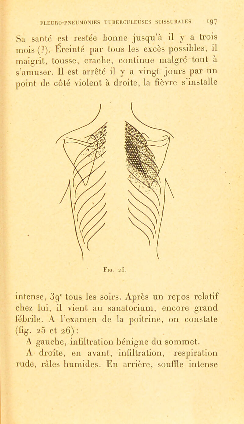 Sa santé est restée bonne jusqu’à il y a trois mois (?). Ereinté par tous les excès possibles, il maigrit, tousse, crache, continue malgré tout à s’amuser. Il est arrêté il y a vingt jours par un point de côté violent à droite, la fièvre s’installe intense, 3g0 tous les soirs. Après un repos relatif chez lui, il vient au sanatorium, encore grand fébrile. A l'examen de la poitrine, on constate (fig. 2 5 et 26) : A gauche, infiltration bénigne du sommet. A droite, en avant, infiltration, respiration rude, râles humides. En arrière, souffle intense