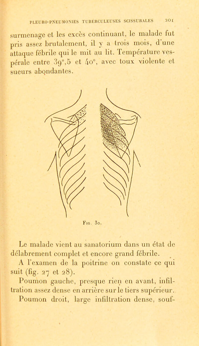 surmenage el les excès continuant, le malade fut pris assez brutalement, il y a trois mois, d’une attaque fébrile qui le mit au lit. Température ves- pérale entre 39°,5 et 4o°, avec toux violente el sueurs abondantes. Le malade vient au sanatorium dans un état de délabrement complet et encore grand fébrile. A l’examen de la poitrine on constate ce qui suit (fig. 27 el 28). Poumon gauebe, presque rien en avant, infil- tration assez dense en arrière sur le tiers supérieur. Poumon droit, large infiltration dense, souf-