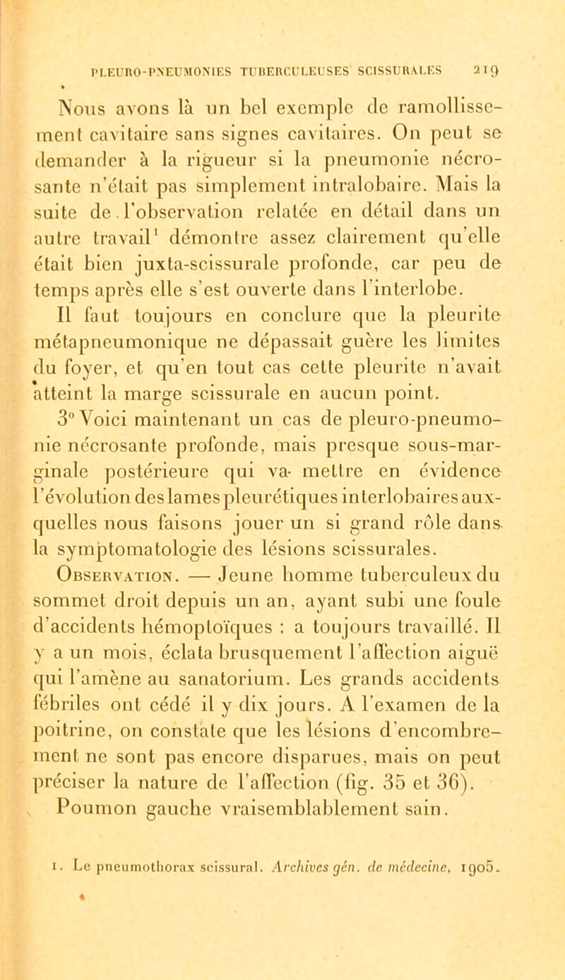 Nous avons là un bel exemple de ramollisse- ment cavitaire sans signes cavitaires. On peut se demander à la rigueur si la pneumonie nécro- sante n’était pas simplement intralobaire. Mais la suite de. l’observation relatée en détail dans un autre travail1 démontre assez clairement qu elle était bien juxta-scissurale profonde, car peu de temps après elle s’est ouverte dans l’interlobe. Il faut toujours en conclure que la pleurite métapneumonique ne dépassait guère les limites du foyer, et qu’en tout cas celte pleurite n’avait atteint la marge scissurale en aucun point. 3° Voici maintenant un cas de pleuro-pneumo- nie nécrosante profonde, mais presque sous-mar- ginale postérieure qui va- mettre en évidence l'évolution deslamespleurétiques interlobaires aux- quelles nous faisons jouer un si grand rôle dans la symptomatologie des lésions scissurales. Observation. — Jeune homme tuberculeux du sommet droit depuis un an, ayant subi une foule d’accidents hémoptoïques : a toujours travaillé. 11 y a un mois, éclata brusquement l'affection aiguë qui l’amène au sanatorium. Les grands accidents fébriles ont cédé il y dix jours. A l'examen de la poitrine, on constate que les lésions d’encombre- ment ne sont pas encore disparues, mais on peut préciser la nature de l alTeclion (fig. 35 et 36). Poumon gauche vraisemblablement sain. i. Le pneumothorax scissural. Archives gén. de médecine, i(jo5_