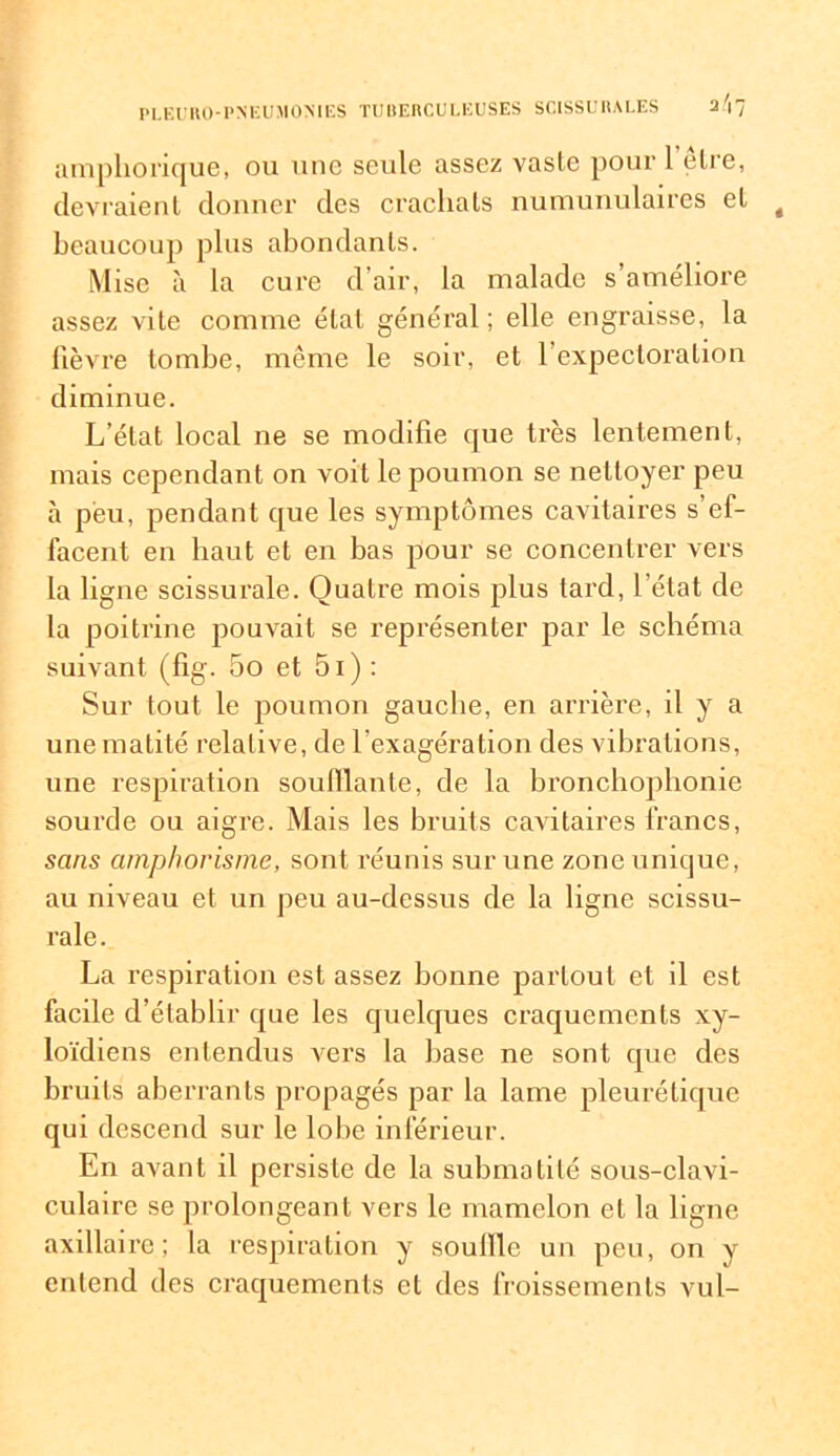 amphorique, ou une seule assez vaste pour 1 être, devraient donner des crachats numunulaires et beaucoup plus abondants. Mise à la cure d'air, la malade s’améliore assez vite comme état général; elle engraisse, la lièvre tombe, même le soir, et l’expectoration diminue. L’état local ne se modifie que très lentement, mais cependant on voit le poumon se nettoyer peu à peu, pendant que les symptômes cavitaires s’ef- facent en haut et en bas pour se concentrer vers la ligne scissurale. Quatre mois plus tard, l’état de la poitrine pouvait se représenter par le schéma suivant (fig. 5o et 51 ) : Sur tout le poumon gauche, en arrière, il y a une matité relative, de l’exagération des vibrations, une respiration souillante, de la bronchophonie sourde ou aigre. Mais les bruits cavitaires francs, sans amphorisme, sont réunis sur une zone unique, au niveau et un peu au-dessus de la ligne scissu- rale . La respiration est assez bonne partout et il est facile d’établir que les quelques craquements xy- loïdiens entendus vers la base ne sont que des bruits aberrants propagés par la lame pleurétique qui descend sur le lobe inférieur. En avant il persiste de la submatilé sous-clavi- culaire se prolongeant vers le mamelon et la ligne axillaire; la respiration y souille un peu, on y entend des craquements et des froissements vul-