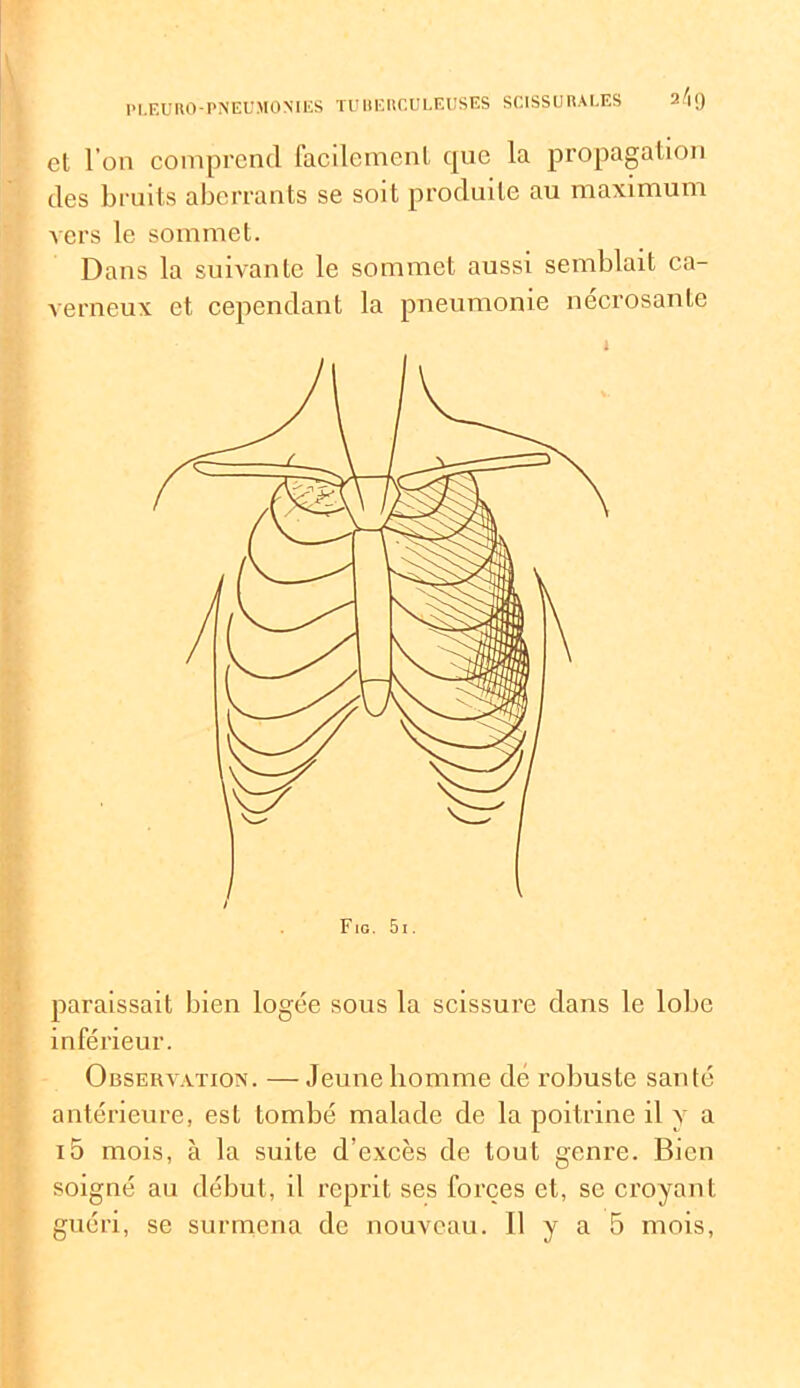 2/19 et l’on comprend facilement que la propagation des bruits aberrants se soit produite au maximum vers le sommet. Dans la suivante le sommet aussi semblait ca- verneux et cependant la pneumonie nécrosante paraissait bien logée sous la scissure dans le lobe inférieur. Observation. — Jeune homme dé robuste santé antérieure, est tombé malade de la poitrine il y a i5 mois, à la suite d’excès de tout genre. Bien soigné au début, il reprit ses forces et, se croyant