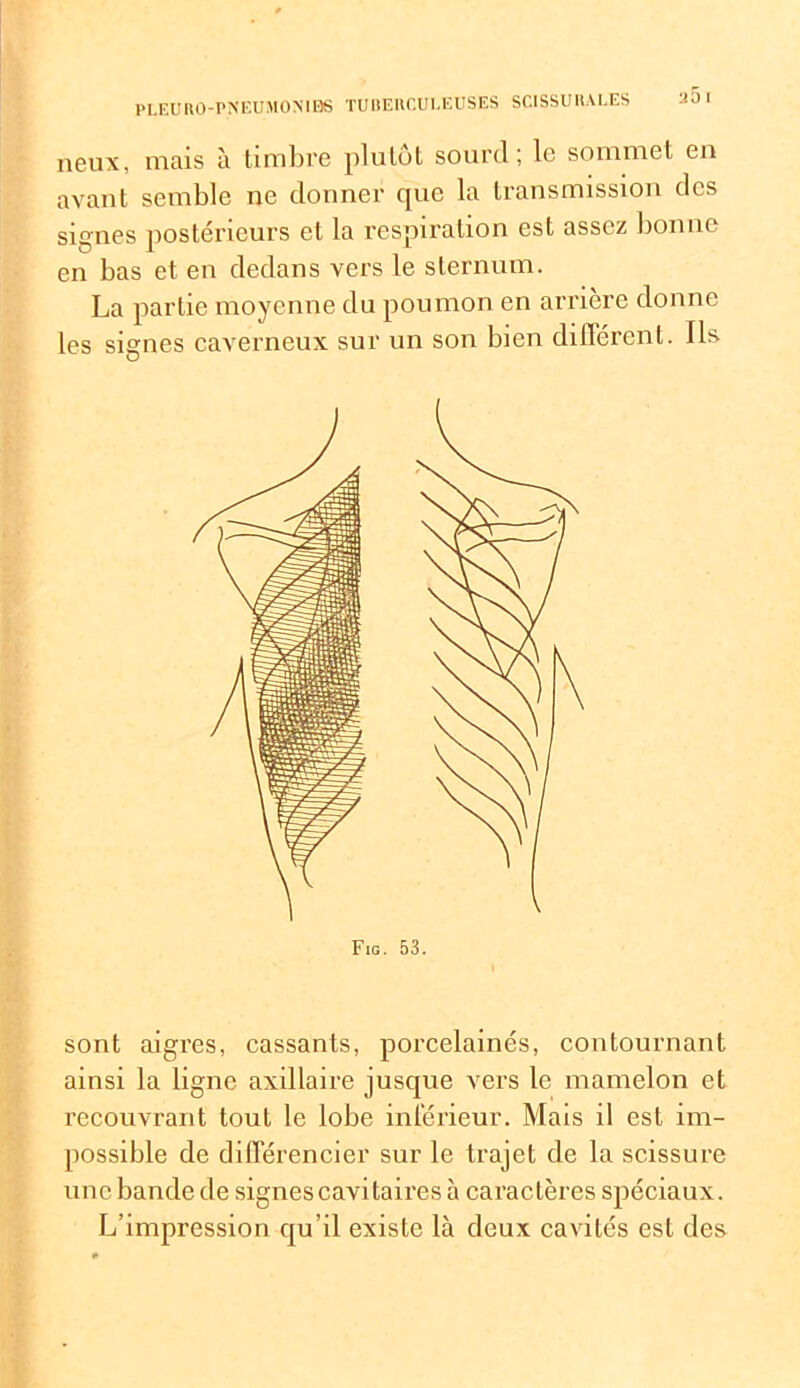 neux, mais à timbre plutôt sourd; le sommet en avant semble ne donner que la transmission des signes postérieurs et la respiration est assez bonne en bas et en dedans vers le sternum. La partie moyenne du poumon en arrière donne les signes caverneux sur un son bien différent. Ils Fjg. 53. sont aigres, cassants, porcelainés, contournant ainsi la ligne axillaire jusque vers le mamelon et recouvrant tout le lobe inférieur. Mais il est im- possible de différencier sur le trajet de la scissure une bande de signescavitaires à caractères spéciaux. L’impression qu’il existe là deux cavités est des