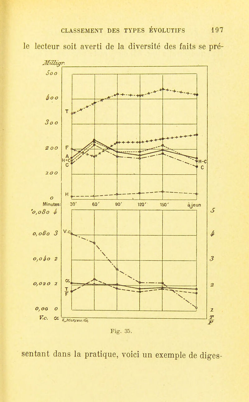 le lecteur soit averti de la diversité des faits se pré- Soo IjiOO 3 o i ZOO o Minutes '0,080 if 0,060 3 o.oio 2 0,0ao 3 0,00 o V.C. a 30' 6D' 80' 120' 150' V.c 1 \ \ —V- > r ■> L »— > :z ^. ( \ z F Fig. 35. sentant dans la pratique, voici un exemple de diges-