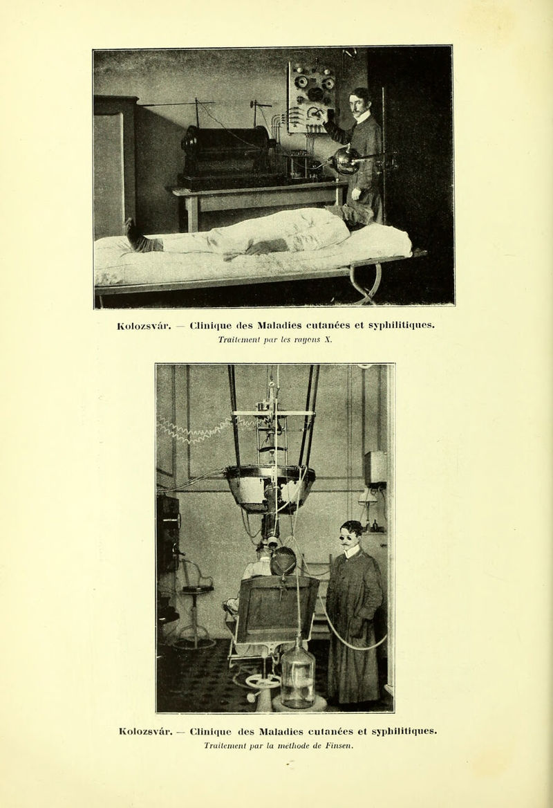 Kolo/svâr. — Clinique des Maladies cutanées et syphilitiques. Traileineiit par la méthode de Fiiiseii.