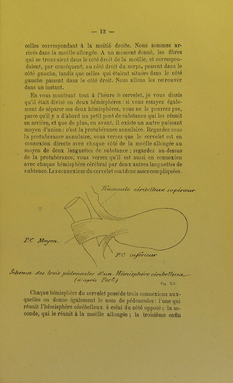 celles correspondant à la moitié droite. Nous somines ar- rivés dans la moelle allongée. A un moment donné, les fibres qui se trouvaient dans le côié droii de la moelle, et correspon- daient, par conséquent, au côté droit du corps, passent dans le côté gauche, tandis que celles qui étaient situées dans le côté gauche passent dans le côté droit. Nous allons les retrouver dans un instant. En vous montrant tout à l'heure le cervelet, je vous disais qu'il était divisé en deux hémisphères : si vous essaj'ez égale- ment de séparer ces deux hémisphères, vous ne le pourrez pas, parce qu'il y a d'abord un petit pont de substance qui les réunit en arrière, et que de plus, en avant, il existe un autre puissant moyen d'union: c'est la protubérance annulaire. Regardez sous la protubérance annulaire, vous verrez que le cervelet est en connexion directe avec chaque côté de la moelle allongée au moyen de deux languettes de substance ; regardez au-dessus de la protubérance, vous verrez qu'il est aussi en connexion avec chaque hémisphère cérébral par deux autres languettes de subtance.LesconnexionE du cervelet sontdonc assez compliquées. Chaque hémisphère du cervelet possède trois connexions aux- quelles on donne également le nom de pédoncules : l'une qui réunit l'hémisphère cérébelleux à celui du côté opposé ; la se- conde, qui le réunit à la moelle allongée ; la troisième enfin l'-ig. XII.