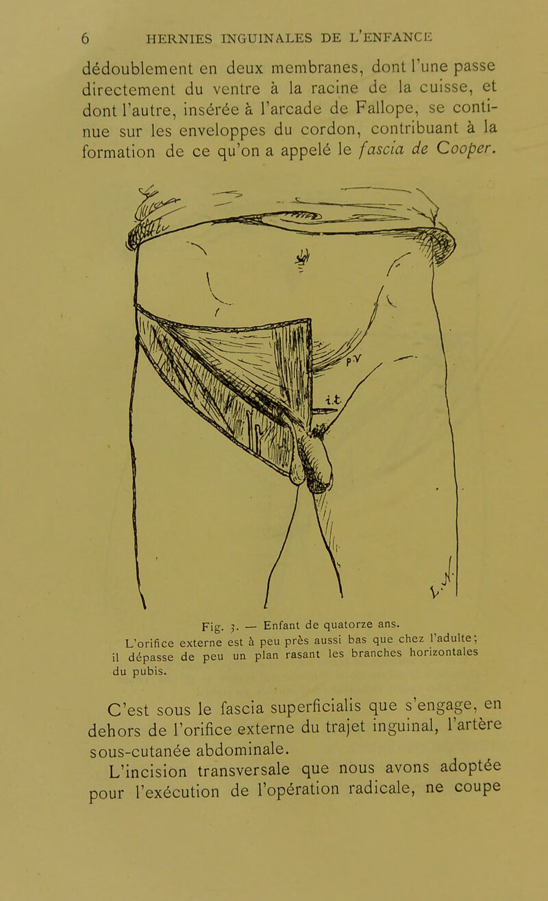 dédoublement en deux membranes, dont Tune passe directement du ventre à la racine de la cuisse, et dont l'autre, insérée à l'arcade de Fallope, se conti- nue sur les enveloppes du cordon, contribuant à la formation de ce qu'on a appelé le fascia de Cooper. Pig. 5. _ Enfant de quatorze ans. L'orifice externe est à peu près aussi bas que chez l'adulte; il dépasse de peu un plan rasant les branches horizontales du pubis. C'est sous le fascia superficialis que s'engage, en dehors de l'orifice externe du trajet inguinal, l'artère sous-cutanée abdominale. L'incision transversale que nous avons adoptée pour l'exécution de l'opération radicale, ne coupe