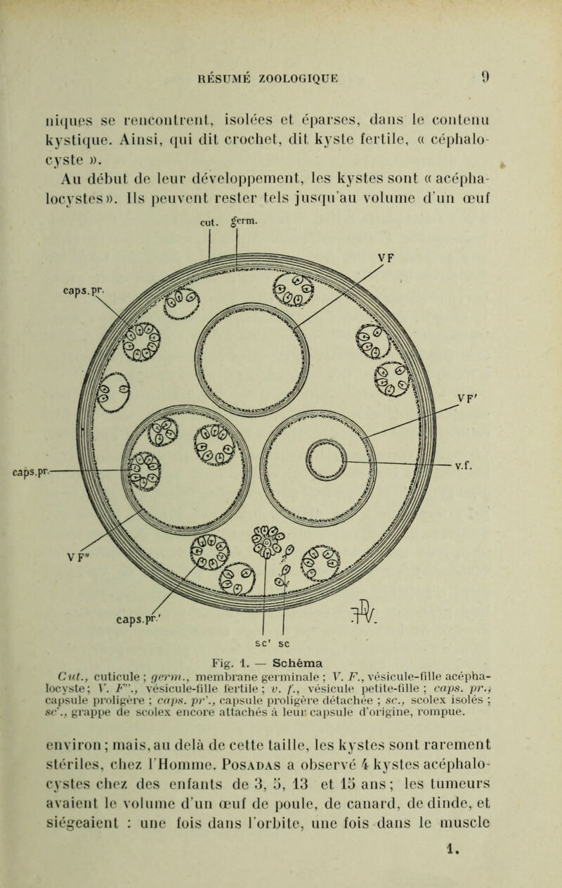 iii(liios se rencontrent, isolées et éparses, dans le contenu kysti(ine. Ainsi, qui dit crochet, dit kyste fertile, « céphalo- cyste ». Au début de leur développement, les kystes sont a acépha- locystes». Ils peuvent rester tels jusqu’au volume d’un œuf Fig. 1. — Schéma Cut., cuticule ; membrane germinale ; U. F., vésicule-fille acépha- locyste; V. F'\, vésicule-fille fertile; v. vésicule petite-fille; caps, pr., ca()sule pi'oligére ; caps, pr'., capsule proligère détachée ; sc., scolex isolés ; SC ., grappe de scolex encore attachés à leur capsule d’origine, rompue. environ ; mais, au delà de cette taille, les kystes sont rarement stériles, chez rHomme. Posadas a observé 4 kystes acéphalo- cystes chez des enfants de 3, 5, 13 et 13 ans; les tumeurs avaient le volume d’un œuf de poule, de canard, de dinde, et siégeaient : une fois dans l’orbite, une fois dans le muscle 1.