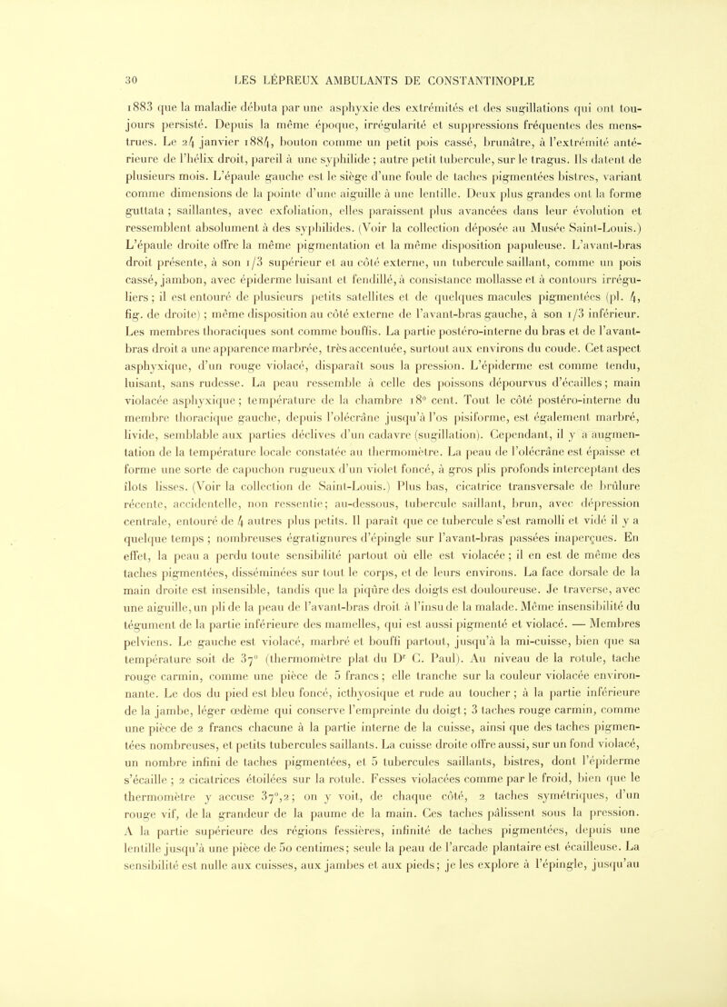 i883 que la maladie débuta par une asphyxie des extrémités et des sugillations qui ont tou- jours persisté. Depuis la même époque, irrégularité et suppressions fréquentes des mens- trues. Le 24 janvier 1884, bouton comme un petit pois cassé, brunâtre, à l'extrémité anté- rieure de l'hélix droit, pareil à une syphilide ; autre petit tubercule, sur le trag'us. Ils datent de plusieurs mois. L'épaule gauche est le sièg-e d'une foule de taches pig-mentées bistres, variant comme dimensions de la pointe d'une aiguille à une lentille. Deux plus g'randes ont la forme g-uttata ; saillantes, avec exfoliation, elles paraissent plus avancées dans leur évolution et ressemblent absolument à des syphilides. (Voir la collection déposée au Musée Saint-Louis.) L'épaule droite offre la même pig'mentation et la même disposition papuleuse. L'avant-bras droit présente, à son i/3 supérieur et au côté externe, un tubercule saillant, comme un pois cassé, jambon, avec épiderme luisant et fendillé, à consistance mollasse et à contours irrég'u- liers ; il est entouré de plusieurs petits satellites et de quelques macules pigmentées (pl. 4^ fîg-. de droite) ; même disposition au côté externe de l'avant-bras g-auche, à son i/3 inférieur. Les membres thoraciques sont comme bouffis. La partie postéro-interne du bras et de l'avant- bras droit a une apparence marbrée, très accentuée, surtout aux environs du coude. Cet aspect asphyxique, d'un roug-e violacé, disparaît sous la pression. L'épiderme est comme tendu, luisant, sans rudesse. La peau ressemble à celle des poissons dépourvus d'écaillés ; main violacée asphyxi([ue ; température de la chambre 18° cent. Tout le côté postéro-interne du membre thoracique gauche, depuis l'olécrâne jusqu'à l'os pisiforme, est également marbré, livide, semblable aux parties déclives d'un cadavre (sug-illation). Cependant, il y a augmen- tation de la température locale constatée au thermomètre. La peau de l'olécrâne est épaisse et forme une sorte de capuchon rugueux d'un violet foncé, à g-ros plis profonds interceptant des îlots lisses. (Voir la collection de Saint-Louis.) Plus bas, cicatrice transversale de brûlure récente, accidentelle, non ressentie; au-dessous, tubercule saillant, brun, avec dépression centrale, entouré de 4 autres plus petits. Il paraît que ce tubercule s'est ramolli et vidé il y a quelque temps ; nombreuses ég'ratignures d'éping-le sur l'avant-bras passées inaperçues. En effet, la peau a perdu toute sensibilité partout où elle est violacée ; il en est de même des taches pigmentées, disséminées sur tout le corps, et de leurs environs. La face dorsale de la main droite est insensible, tandis que la piqûre des doigts est douloureuse. Je traverse, avec une aig-uillcjun pli de la peau de l'avant-bras droit à l'insude la malade. Môme insensibilité du tégument de la partie inférieure des mamelles, qui est aussi pig-menté et violacé. — Membres pelviens. Le gauche est violacé, marbré et bouffi partout, jusqu'à la mi-cuisse, bien que sa température soit de 87° (thermomètre plat du D'' C. Paul). Au niveau de la rotule, tache roug-e carmin, comme une pièce de 5 francs ; elle tranche sur la couleur violacée environ- nante. Le dos du pied est bleu foncé, icthyosique et rude au toucher ; à la partie inférieure de la jambe, lég-er œdème qui conserve l'empreinte du doig-t; 3 taches rouge carmin^, comme une pièce de 2 francs chacune à la partie interne de la cuisse, ainsi que des taches pig^men- tées nombreuses, et petits tubercules saillants. La cuisse droite offre aussi, sur un fond violacé, un nombre infini de taches pigmentées, et 5 tubercules saillants, bistres, dont l'épiderme s'écaille ; 2 cicatrices étoilées sur la rotule. Fesses violacées comme par le froid, bien que le thermomètre y accuse 37^2; on y voit, de chaque côté, 2 taches symétriques, d'un rouge vif, de la grandeur de la paume de la main. Ces taches pâlissent sous la pression. A la partie supérieure des régions fessières, infinité de taches pigmentées, depuis une lentille jusqu'à une pièce de 5o centimes; seule la peau de l'arcade plantaire est écailleuse. La sensibilité est nulle aux cuisses, aux jambes et aux pieds; je les explore à l'épingle, jusqu'au