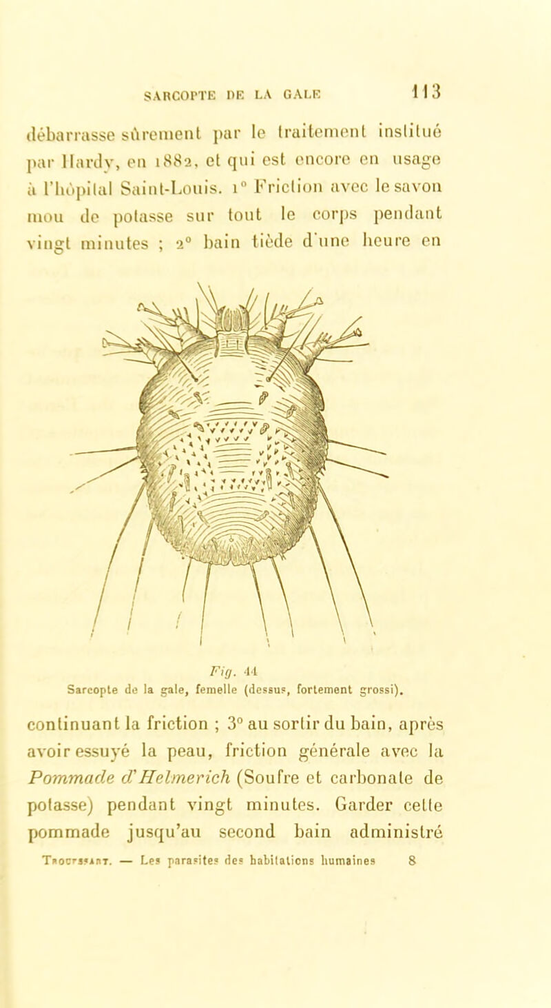 SARCOPTE DE LA GALE 1 I 3 débarrasse sûrement par le traitement institué par llardy, en 1882, et qui est encore en usage à l’hopilal Saint-Louis. i° Friction avec le savon mou de potasse sur tout le corps pendant vingt minutes ; 20 bain tiède d une heure en Fig. U Sarcopte de la gale, femelle (dessu?, fortement grossi). continuant la friction ; 3° au sortir du bain, après avoir essuyé la peau, friction générale avec la Pommade d'Helmerich (Soufre et carbonate de potasse) pendant vingt minutes. Garder celte pommade jusqu’au second bain administré T»ocrs?inT. — Les parasites des habitations humaines 8