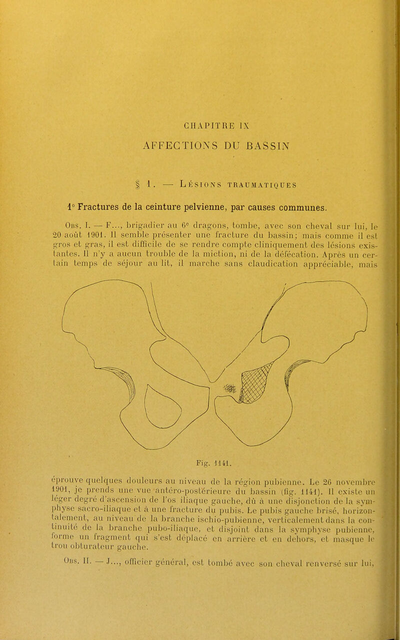 CHAPITRE IX AFFECTIONS DU BASSIN § 1. — Lésions traumatiques 1° Fractures de la ceinture pelvienne, par causes communes. Obs. I. — F..., brigadier au 6 dragons, tombe, avec son cheval sur lui, le 20 août 1901. Il semble présenter une fracture du bassin; mais comme il est gros et gras, il est difficile de se rendi-e compte cliniquement des lésions exis- tantes. 11 n'y a aucun trouble de la miction, ni de la défécation. Après un cer- tain temps de séjour au lit, il marche sans claudication appréciable, mais Fig. J141. éprouve quelques douleurs au niveau de la région pubienne. Le 20 novembre 1901, je prends une vue antéro-postérieure du bassin (lig. 1141). Il existe un léger degré d'ascension de l'os iliaque gauche, dû cà une disjonction de la sym- physe sacro-iliaque et à une fracture du pubis. Le pubis gauche brisé, horizon- talement, au niveau de la branche ischio-pubienne, verticalement dans la con- tinuité de la branche pubo-iliaque, et disjoint dans la symphyse pubienne, lormo un fragment qui s'est déplacé en arrière et en dehors,et masque le ti'ou obturateur gauche. Obs. II. — .1..., officier général, est tombé avec son cheval renversé sur lui,