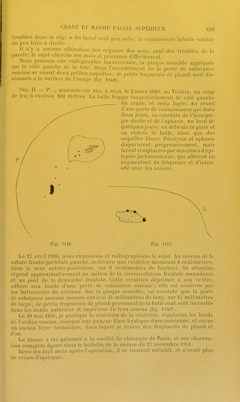 CllANK ET MASSIF h'ACIAI. SCI'KlilKlîR |)(MI IKM commissure labiale semble (roubles fhuis la réj>'i ii du facial siiui un peu tirée à ciroile. Il n'y a aucune altcraliou dos ornaiies des sens, sauf dos troubles de la [jarolc: le sujet cherche ses mois et ijrononce difficilemenl. Nous prenons une radiographie transversale, la plaque sensible appliquée sur le cote gauche de la tète. Dans l'encadrement de la perte de substance osseuse se voient deux petites esquilles; de petits fragments de plomb sont dis- séminés à la surlace de l'image (fig. 1148). Obs. 11. — P..., quarante-un ans, a reçu, le 2 mars 188.=>, au Tonkin, un coup de leu, a environ 200 mètres. La balle frappa tangentieilement le cùté gauche du crâne, et resta logée. Au réveil d'une perte de connaissance qui dura deux jours, on constata de l'hémiplé- gie droite et de l'aphasie. Au bout de quelques jours, on débrida la plaie et on enleva la balle, ainsi que des esquilles libres. Paralysie et aphasie disparurent progressivement, mais furent remplacées par des crises d'épi- lepsie jacksonnienne, qui allèrent en augmentant de fréquence et d'inten- sité avec les années. Fis. M48. Fie. 1149. Le 27 avril 1900, nous examinons et radiographions le sujet. Au niveau de la suture fronto-pariétale gauche, se trouve une cicatrice mesurant 5 centimètres, dans le sens antéro-postéricur, sur 2 centimètres de hauteur. Sa situation, répond approximativement au milieu delà circonvolution frontale ascendante et au pied de la deuxième frontale. Cette cicatrice déprimée à son centre, adhère aux bords d'une perte de substance osseuse; elle est soulevée pai- les battements du cerveau. Sur la plaque sensible, on constate que la perte de substance osseuse mesure environ 35 millimètres de long, sur 15 millimètres de large; de petits fragments de plomb provenantde la balle sont sont incrustés dans les bords antérieur et supérieur du trou osseux (fig. i 149). Le 28 mai 1901, je pratique la résection de la cicatrice, régularise les bords de l'orifice osseux, résèque une gangue fibro-kystiquc dure-mérienne, et ouvre un ancien foyer hématiqiie, dans lequel je trouve dos i'ragmonls do plomb et d'os. Le blessé a été présenté à la société de chirurgie de Paris, et son ob.serva- tion complète figure dans le bulletin de la séance du 27 novembre 19(H. Uevu dix-huit mois après l'opéralion, il se trouvait satisfait, et n'avail plus de crises d'épilepsie.