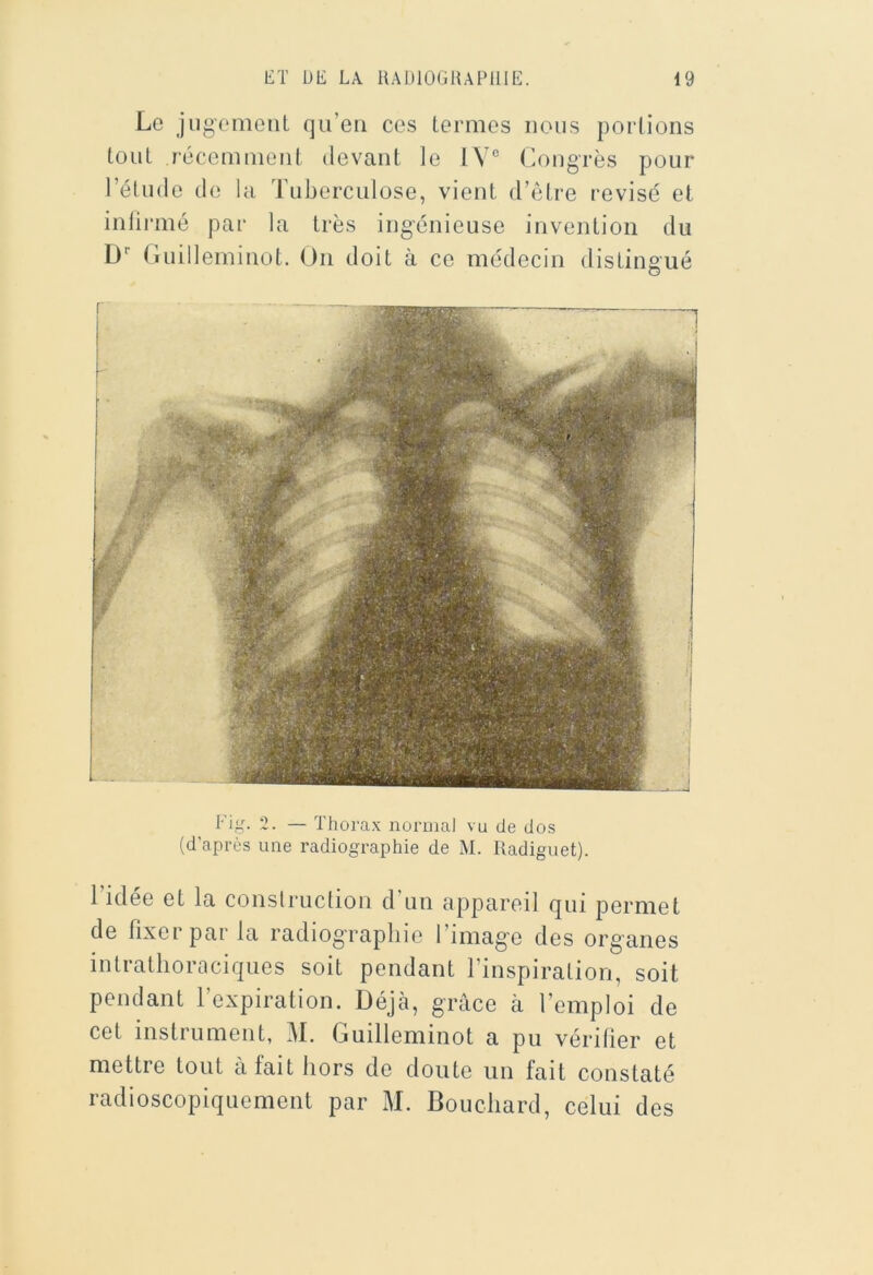 Le jugement qu’en ces termes nous perlions tout l’écemment devant le 1V° Cougrès pour rétiide de la Tuberculose, vient d’être révisé et inlii-mé par la très ingénieuse invention du D'’ (luilleminot. On doit à ce médecin distingué Fig. 2. — ïhora.x iiorDial vu de dos (d’après une radiographie de M. Radiguet). l’idée et la conslruction d’un appareil qui permet de fixer par la radiographie l’image des organes intrathoraciques soit pendant l’inspiration, soit pendant l’expiration. Déjà, grâce à l’emploi de cet instrument, M. Guilleminot a pu vérifier et mettre tout a fait hors de doute un fait constaté radioscopiquement par M. Bouchard, celui des