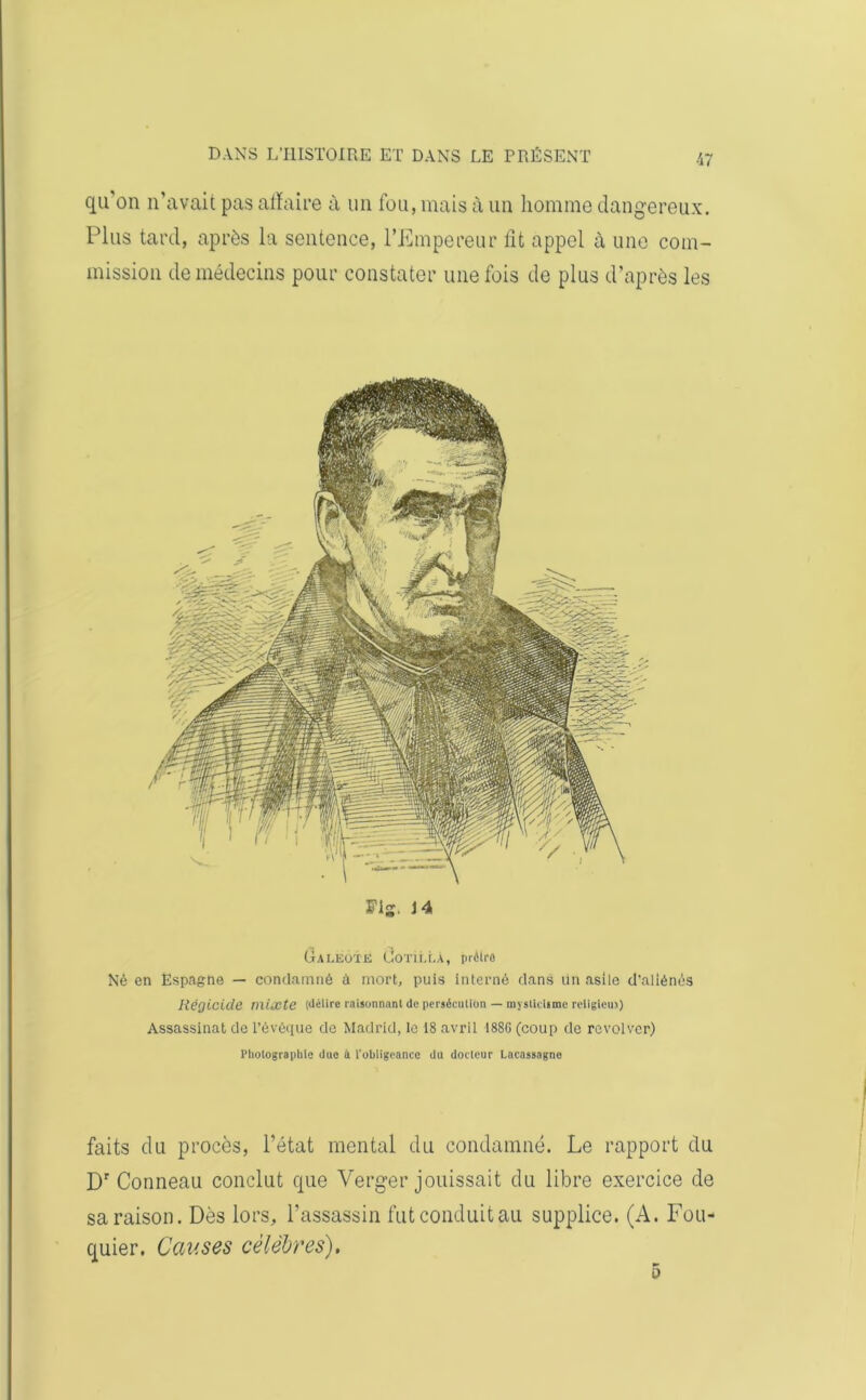 qu'on n’avait pas affaire à un fou, mais à un homme dangereux. Plus tard, après la sentence, l’Empereur fit appel à une com- mission de médecins pour constater une fois de plus d’après les Fig. 14 Galeote (JoTiLLÂ, prélro Né en Espagne — condamné à mort, puis interné dans lin asile d’aliénés Régicide mixte (délire raisonnant de perséculion — mysticisme religieux) Assassinat de l’évêque de Madrid, le 18 avril 1886 (coup de revolver) Photographie due à l’obligeance du docteur Lacassagne faits du procès, l’état mental du condamné. Le rapport du Dr Conneau conclut que Verger jouissait du libre exercice de sa raison. Dès lors, l’assassin futconduitau supplice. (A. Fou- quier. Causes célèbres). ü
