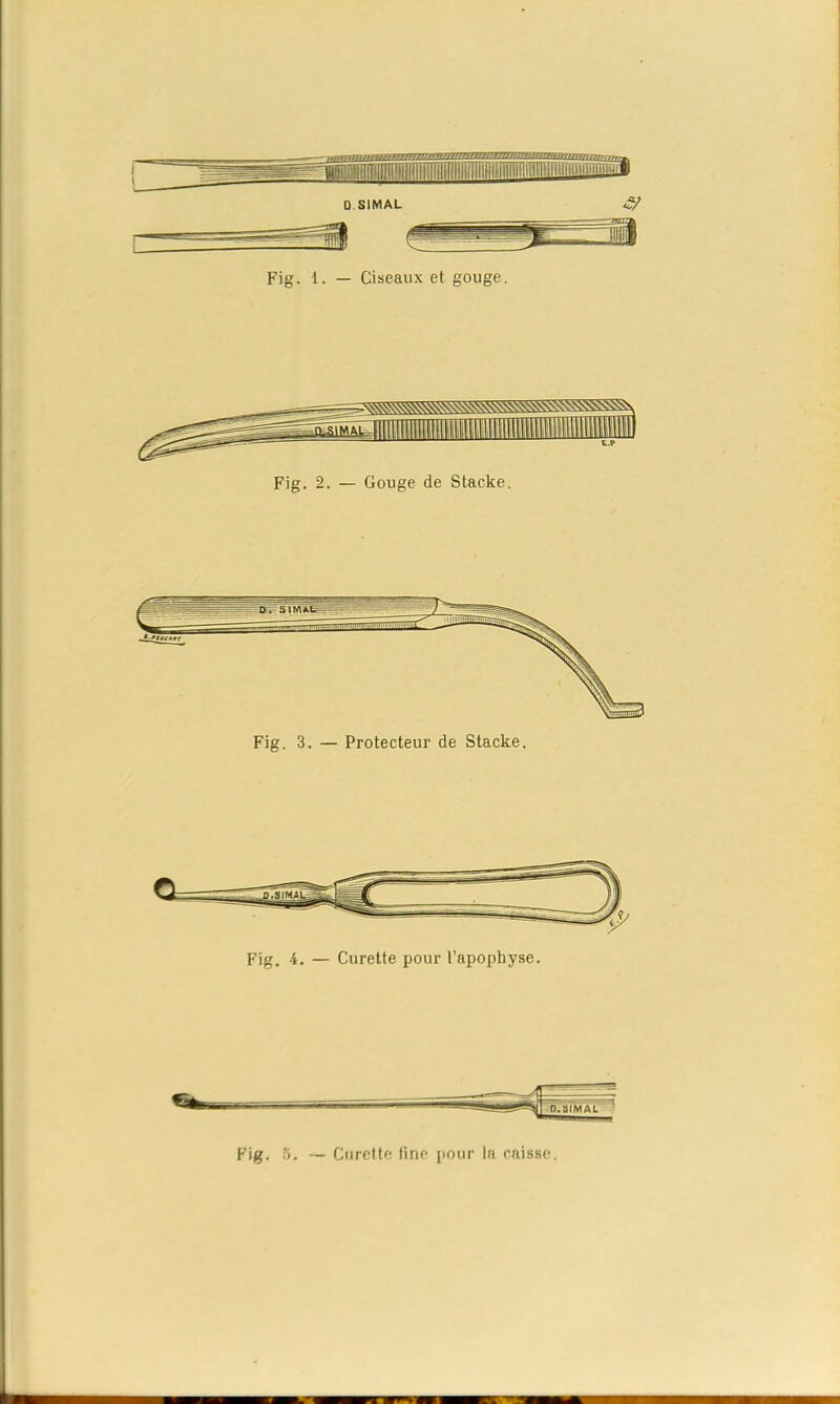 Fig. 1. — Ciseaux et gouge. Fig. 2. — Gouge de Stacke. Fig. 4. — Curette pour l’apophyse. Fig. 5. — Curette fine pour la caisse.