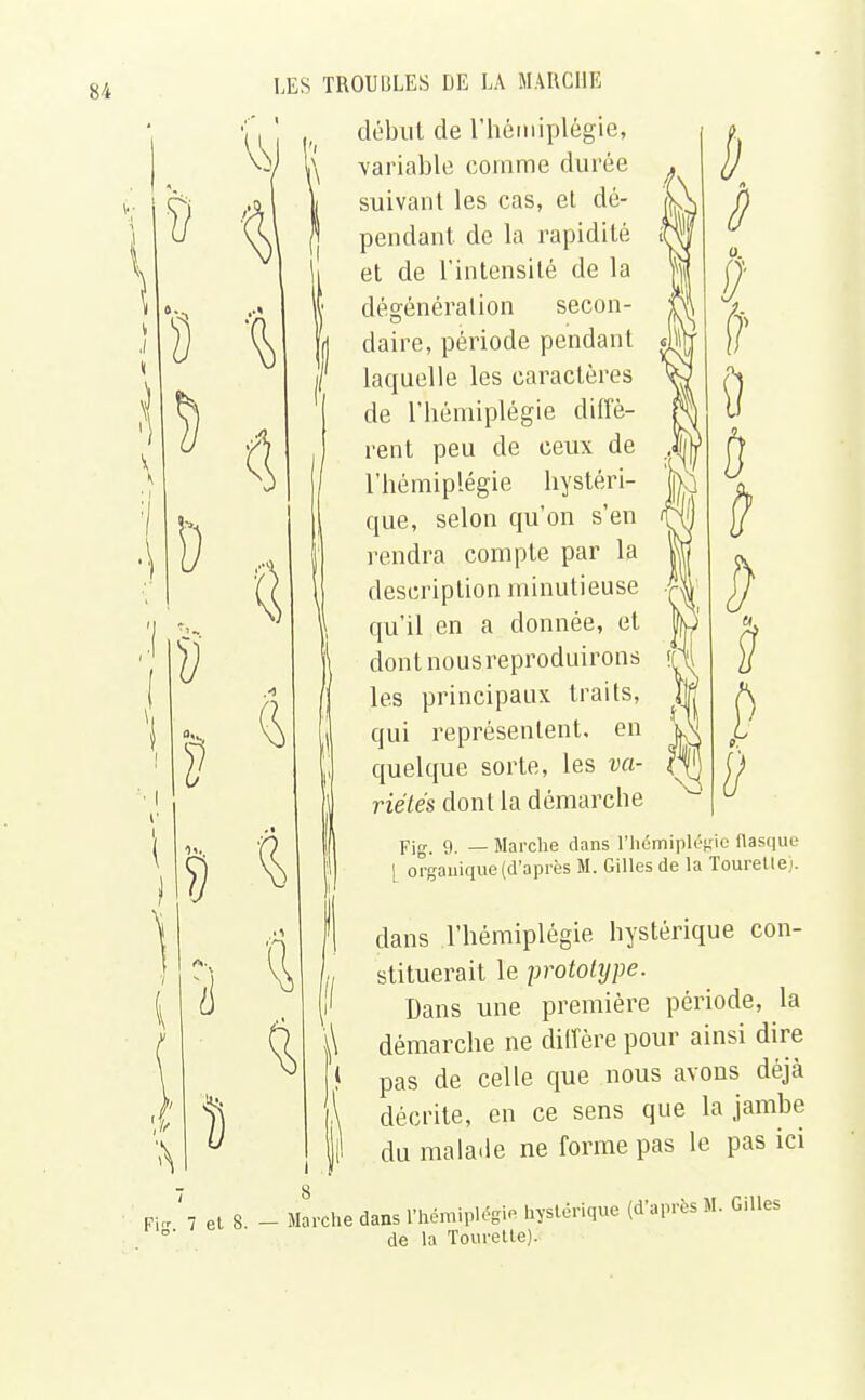 début de l'hémiplégie, variable comme durée suivant les cas, el dé- pendant de la rapidité et de l'intensité de la décélération secon- daire, période pendant laquelle les caractères de l'hémiplégie diffè- rent peu de ceux de l'hémiplégie hystéri- que, selon qu'on s'en rendra compte par la description minutieuse qu'il en a donnée, et dont nousreproduirons les principaux traits, qui représentent, en quelque sorte, les va- riétés dont la démarche Fig. 9. — Marche dans l'hémipléi 1 organique (d'après M. Gilles de la ;ie flasque Tourellej. dans l'hémiplégie hystérique con- stituerait le prototype. Dans une première période, la démarche ne diffère pour ainsi dire pas de celle que nous avons déjà décrite, en ce sens que la jambe du malade ne forme pas le pas ici •Che dans l'hémiplégie hystérique (d'après M. Gilles de la Touretle).