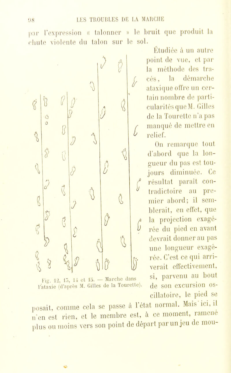 par l'expression « talonner chute violente du talon sur (5 0 3 \ J v Ù » le bruit que produit la le sol. Etudiée à un autre point de vue, et par la méthode des tra- cés , la démarche ataxique offre un cer- tain nombre de parti- cularités que M. Gilles de la Tourette n'a pas manqué de mettre en relief. On remarque tout d'abord que la lon- gueur du pas est tou- jours diminuée. Ce résultat paraît con- tradictoire au pre- mier abord; il sem- blerait, en effet, que. la projection exagé- rée du pied en avant devrait donnerai! pas C une longueur exagè- Fi». 12, 15, 1-i et 15. — Marche dans l'ataxie (d'après M. Gilles de la Touretle). rée. C'est ce qui arri- verait effectivement, si, parvenu au bout de son excursion os- cillatoire, le pied se posait, comme cela se passe à l'état normal. Mais'ici. il n'en est rien, et le membre est, à ce moment, ramené plus ou moins vers son point de départ par un jeu de mou-