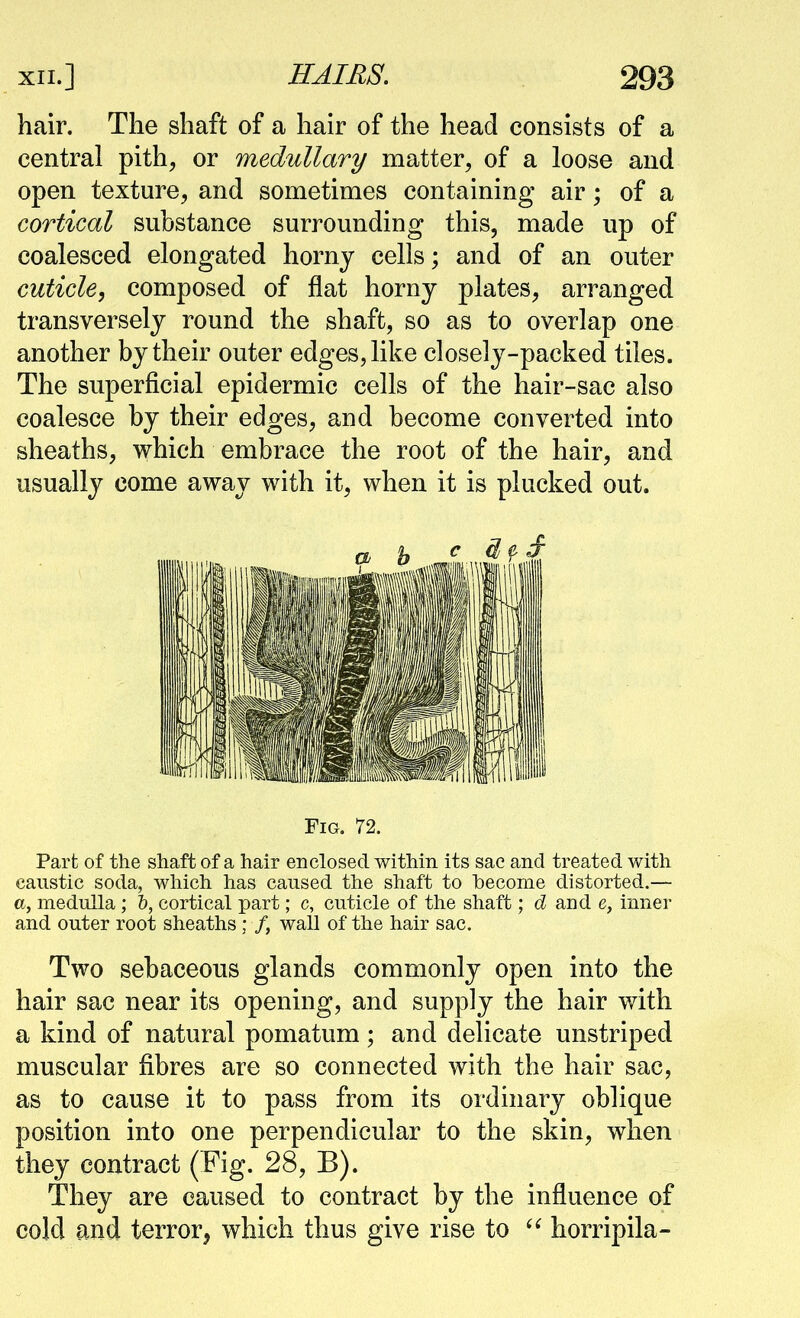 hair. The shaft of a hair of the head consists of a central pith^ or medullary matter, of a loose and open texture, and sometimes containing air; of a cortical substance surrounding this, made up of coalesced elongated horny cells; and of an outer cuticle, composed of flat horny plates, arranged transversely round the shaft, so as to overlap one another by their outer edges, like closely-packed tiles. The superficial epidermic cells of the hair-sac also coalesce by their edges, and become converted into sheaths, which embrace the root of the hair, and usually come away with it, when it is plucked out. Fig. 72. Part of the shaft of a hair enclosed within its sac and treated with caustic soda, which has caused the shaft to become distorted.— a, medulla ; &, cortical part; c, cuticle of the shaft; and e, inner and outer root sheaths ; /, wall of the hair sac. Two sebaceous glands commonly open into the hair sac near its opening, and supply the hair with a kind of natural pomatum; and delicate unstriped muscular fibres are so connected with the hair sac, as to cause it to pass from its ordinary oblique position into one perpendicular to the skin, when they contract (^'ig. 28, B). They are caused to contract by the influence of cold and terror, which thus give rise to horripila-