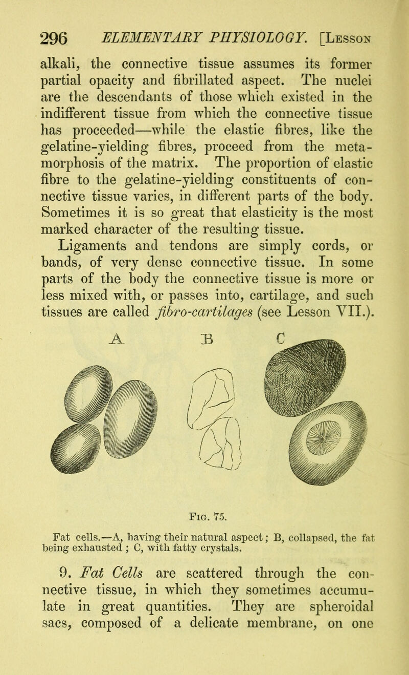 alkali, the connective tissue assumes its former partial opacity and fibrillated aspect. The nuclei are the descendants of those which existed in the indifferent tissue from which the connective tissue has proceeded—while the elastic fibres, like the gelatine-yielding fibres, proceed from the meta- morphosis of the matrix. The proportion of elastic fibre to the gelatine-yielding constituents of con- nective tissue varies, in different parts of the body. Sometimes it is so great that elasticity is the most marked character of the resulting tissue. Ligaments and tendons are simply cords, or bands, of very dense connective tissue. In some parts of the body the connective tissue is more or less mixed with, or passes into, cartilage, and such tissues are called fihro-cartilages (see Lesson YIL). Fig. 75. Fat cells.—A, having their natural aspect; B, collapsed, the fat being exhausted ; C, with fatty crystals. 9. Fat Cells are scattered through the con- nective tissue, in which they sometimes accumu- late in great quantities. They are spheroidal sacs, composed of a delicate membrane, on one