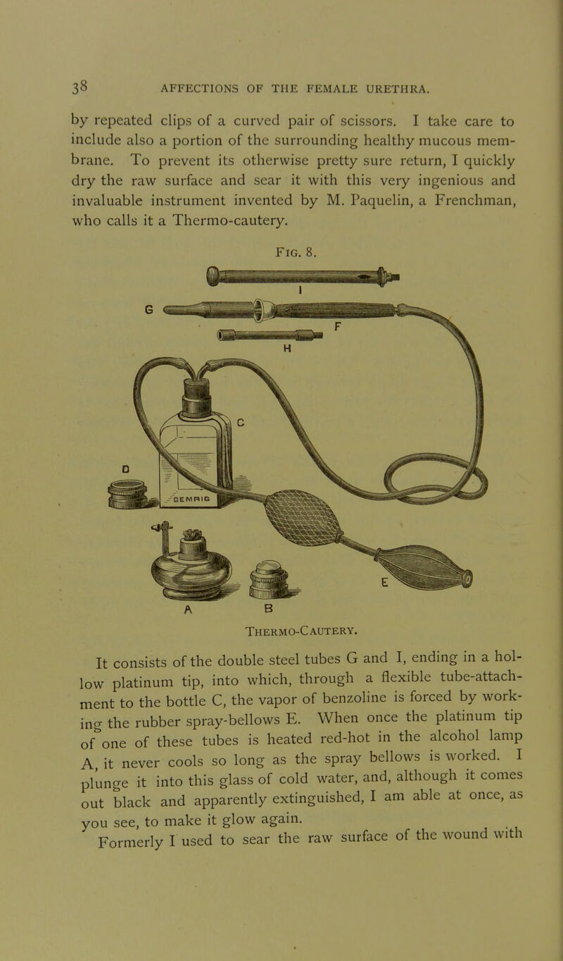 by repeated clips of a curved pair of scissors. I take care to include also a portion of the surrounding healthy mucous mem- brane. To prevent its otherwise pretty sure return, I quickly dry the raw surface and sear it with this very ingenious and invaluable instrument invented by M. Paquelin, a Frenchman, who calls it a Thermo-cautery. Fig. 8. Thermo-Cautery. It consists of the double steel tubes G and I, ending in a hol- low platinum tip, into which, through a flexible tube-attach- ment to the bottle C, the vapor of benzoline is forced by work- ing the rubber spray-bellows E. When once the platinum tip of^'one of these tubes is heated red-hot in the alcohol lamp A it never cools so long as the spray bellows is worked. I plunge it into this glass of cold water, and, although it comes out black and apparently extinguished, I am able at once, as you see, to make it glow again. Formerly I used to sear the raw surface of the wound with