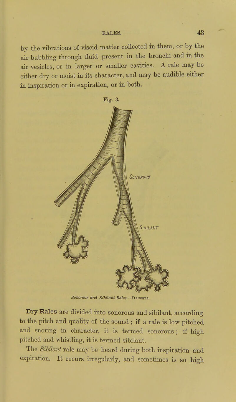 by the vibrations of viscid matter collected in them, or by the ail bubbling through fluid present in the bronchi and in the air vesicles, or in larger or smaller cavities. A rale may be either dry or moist in its character, and may be audible either ia inspiration or in expiration, or in both. Fig. 3. Sonorous and Sibilant Rales.—Baoobia. Dry Rales are divided into sonorous and sibilant, according to the pitch and quahty of the sound ; if a rale is low pitched and snoring in character, it is termed sonorous ; if high pitched and whistling, it is termed sibilant. The Sibilant rale may be heard during both inspiration and expiration. It recurs irregularly, and sometimes is so high