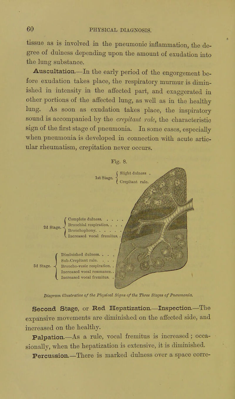 tissue as is involved in the pneumonic inflammation, the de- gree of dulness depending upon the amount of exudation into the lung substance. Auscultation.—In the early period of the engorgement be- fore exudation takes place, the respiratory murmur is dimin- ished in intensity in the affected part, and exaggerated in other portions of the affected lung, as well as in the healthy lung. As soon as exudation takes place, the inspiratory sound is accompanied by the crepitant rale, the characteristic sign of the first stage of pneumonia. In some cases, especially when pneumonia is developed in connection with acute artic- ular rheumatism, crepitation never occurs. Fig. 8. Diagram illustrative of the Physical Signs of the Three Stages of Pneumonia. Second Stage, or Red Hepatization.—Inspection.—The expansive movements are diminished on the affected side, and increased on the healthy. Palpation.—As a rule, vocal fremitus is increased; occa- sionally, when the hepatization is extensive, it is diminished. Percussion.—There is marked dulness over a space corre-