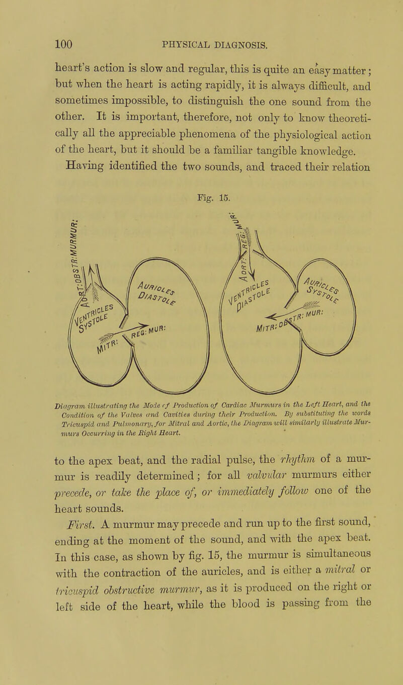 heart's action is slow and regular, this is quite an easy matter; but when the heart is acting rapidly, it is always difficult, and sometimes impossible, to distinguish the one sound from the other. It is important, therefore, not only to know theoreti- cally all the appreciable phenomena of the physiological action of the heart, but it should be a familiar tangible knowledge. Having identified the two sounds, and traced their relation Fig. 15. JHcigram illustratinq the Mode rf Production of Cardiac Murmurs in the Left Heart, and the Condition of the Valves and Cavities during their Production. By substituting the words Tricuspid and Pulmonary, for Mitral and Aortic, the ZHagramioill nimilarly illustrate Mur- murs Occurring in the Bight Heart. to the apex beat, and the radial pulse, the rliythn of a mur- mur is readily determined ; for all valvular murmurs either precede, or take the place of, or immediately folloio one of the heart sounds. First. A murmur may precede and run up to the first sound, ending at the moment of the sound, and with the apex beat. In this case, as shown by fig. 15, the murmur is simultaneous with the contraction of the auricles, and is either a mitral or tricuspid obstructive murmur, as it is produced on the right or left side of the heart, while the blood is passuig fi-om the