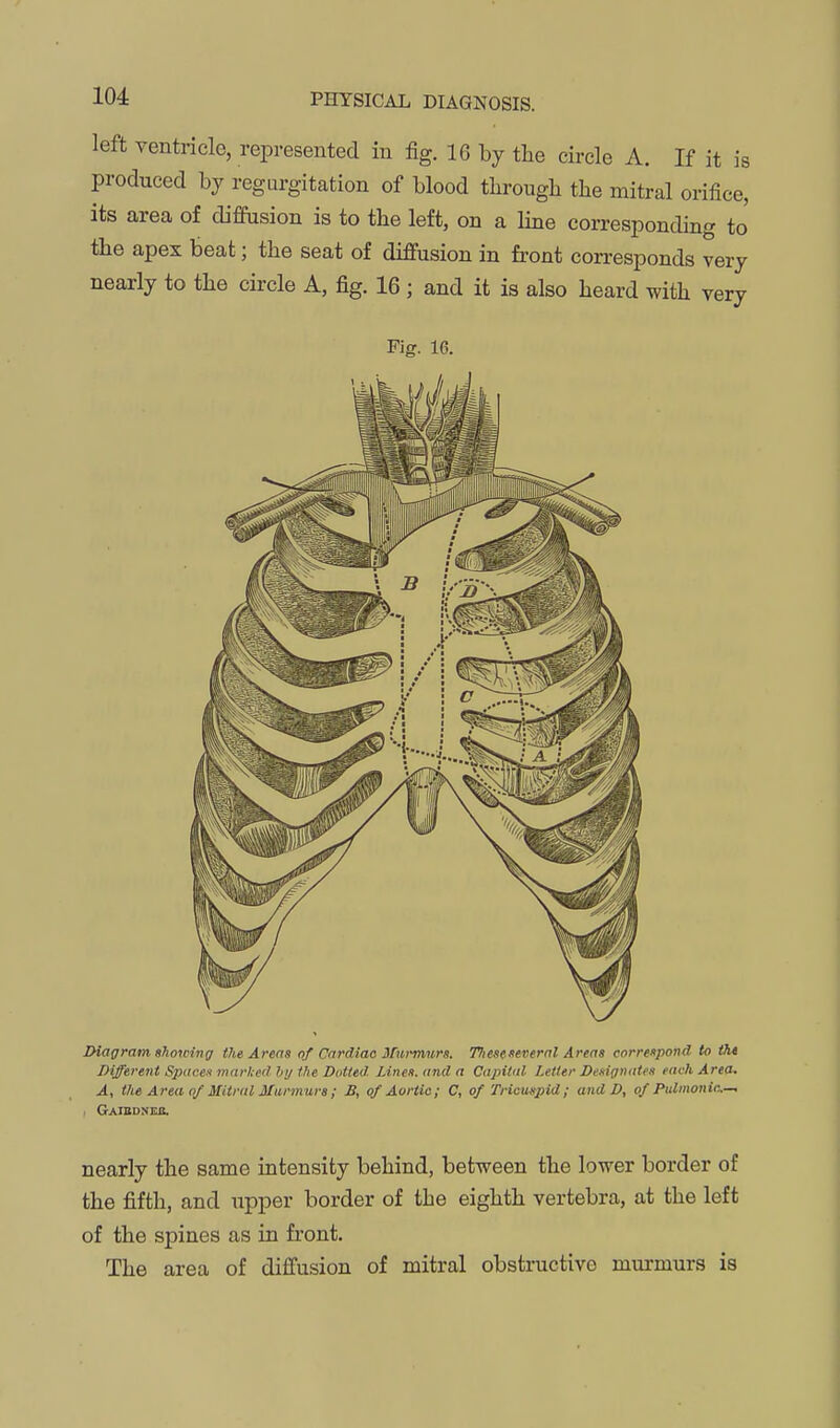 left ventricle, represented in fig. 16 by the circle A. If it is produced by regurgitation of blood through the mitral orifice, its area of diffusion is to the left, on a line corresponding to the apex beat; the seat of diffusion in front con-esponds very nearly to the circle A, fig. 16 ; and it is also heard with very Fig. 16. Diaffram ehowinff the Areas of Onrdiao Ifurmurs. 77iesenevernl Areas correnpond to iht IHffereiit Space.i marked hij Vie Dutted. Lines, and a Capital Letter Designates each Area. A, the Area of Mitral Marmura ; B, qf Aortic; C, of Tricuspid ; and D, of Pulmonic-, I Gaibdneb. nearly the same intensity behind, between the lower border of the fifth, and upper border of the eighth vertebra, at the left of the spines as in front. The area of diffusion of mitral obstructive murmurs is