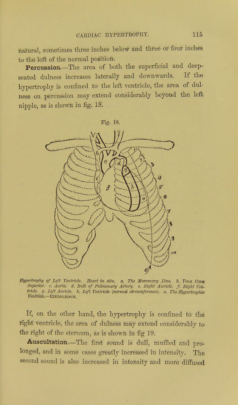 natural, sometimes three inches below and three or fonr inches to the left of the normal position. Percussion.—The area of both the superficial and deep- seated dulness increases laterally and downwards. If the hypertrophy is confined to the left ventricle, the area of dul- ness on percussion may extend considerably beyond the left nipple, as is shown in fig. 18. Fig. 18. Bypertrophy of Left Ventricle. Heart in situ. a. The Mammary Line. 5. Vena Cava Superior, c. Aorta, d. Bulb of Pulmonary Artery, e. Eight Auricle, f. Right Ven- tricle, g. Left Auricle, h. L^ Ventricle (normal circumference), o. Hie Sypertrophie Fei^'^te.—RnrDFLBiscn. If, on the other hand, the hypertrophy is confined to the right ventricle, the area of dulness may extend considerably to the right of the sternum, as is shown in fig 19. Auscultation.—The first sound is dull, muffled and pro- longed, and in some cases greatly increased in intensity. The second sound is also increased in intensity and more difiused