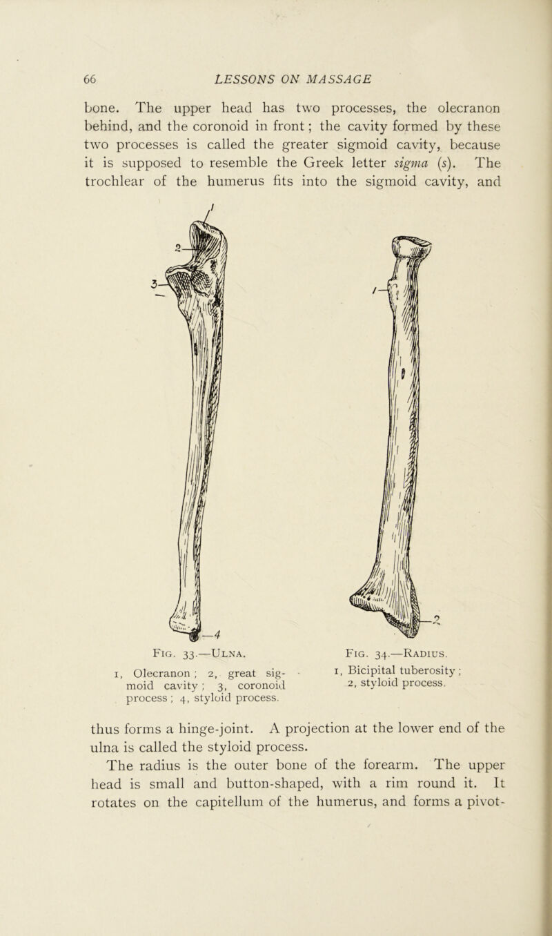 bone. The upper head has two processes, the olecranon behind, and the coronoid in front; the cavity formed by these two processes is called the greater sigmoid cavity, because it is supposed to resemble the Greek letter sigma (s). The trochlear of the humerus fits into the sigmoid cavity, and I, Olecranon ; 2, great sig- moid cavity ; 3, coronoid process ; 4, styloid process. Fig. 34.—Radius. I, Bicipital tuberosity; 2, styloid process. thus forms a hinge-joint. A projection at the lower end of the ulna is called the styloid process. The radius is the outer bone of the forearm. The upper head is small and button-shaped, with a rim round it. It rotates on the capitellum of the humerus, and forms a pivot-