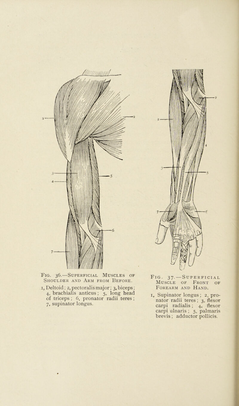 Fig. 36.—Superficial Muscles of Shoulder and Arm from Before. I, Deltoid; 2, pectoralis major; 3, biceps; 4, brachialis anticus ; 5, long head of triceps ; 6, pronator radii teres ; 7, supinator longus. Fig. 37. — Superficial Muscle of Front of Forearm and Hand. I, Supinator longus; 2, pro- nator radii teres ; 3, flexor carpi radialis ; 4, flexor carpi ulnaris ; 5, palmaris brevis; adductor pollicis.