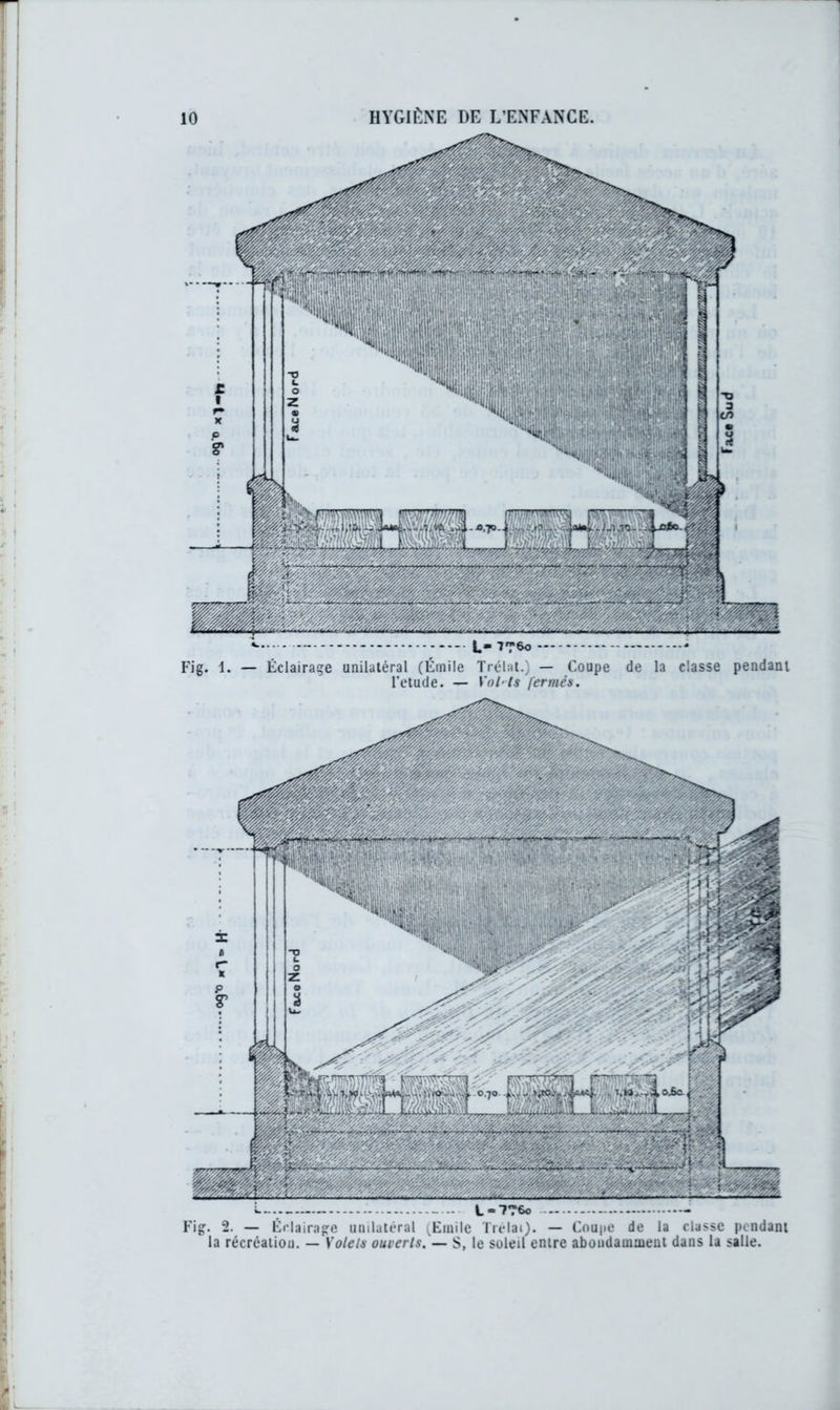 *■ L* 7*760 - Fig. 1. — Éclairage unilatéral (Émile Trélat.) — Coupe de la classe pendant l’etude. — VoMs fermés. L— L-7?6o - Fig. 2. — Éclairage unilatéral (Emile Trélai). — Coupe de la classe pendant la récréation. — Volets ouverts. — S, le soleil entre aboudamment dans la salle.