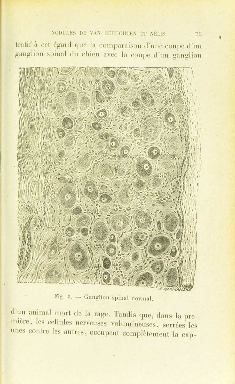 tratif à cet égard que la comparaison d'une coupe d'un ganglion spinal du chien avec la coupe d'un ganglion ,) '■'li ' I ■ - ' , ' W '.» >;■'•// , ' ; ■ , / i y^Xi f (Si ''Ii M Fig-. 3. — Ganglion spinal normal. d'un animal mort de la rage. Tandis que, dans la pre- mière, les cellules nerveuses volumineuses, serrées les unes contre les autres, occupent complètement la cap-