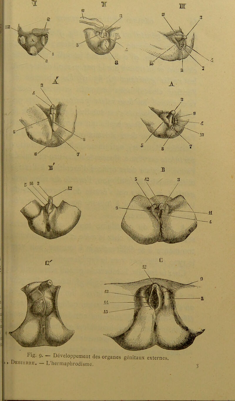 Fig. 9 Développement des organes génitaux externes. .. Debierre. — L’hermaphrodisme. A.