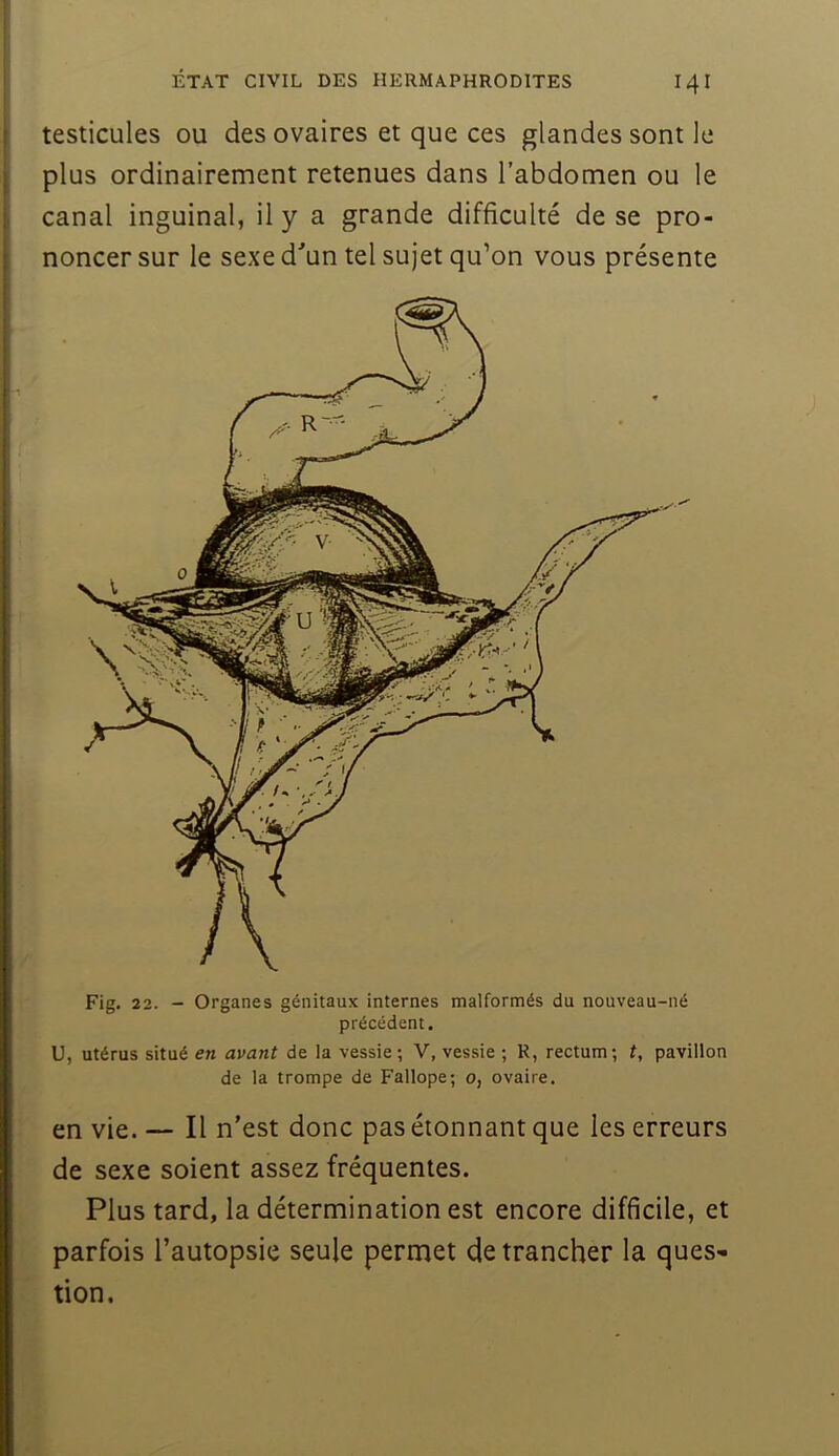 I ÉTAT CIVIL DES HERMAPHRODITES I4I I testicules ou des ovaires et que ces glandes sont le i plus ordinairement retenues dans l’abdomen ou le ; canal inguinal, il y a grande difficulté de se pro- I noncer sur le sexe d'’un tel sujet qu’on vous présente Fig. 22. - Organes génitaux internes malformés du nouveau-né précédent. U, utérus situé en avant de la vessie ; V, vessie ; R, rectum; t, pavillon de la trompe de Fallope; o, ovaire. en vie. — Il n’est donc pas étonnant que les erreurs de sexe soient assez fréquentes. Plus tard, la détermination est encore difficile, et parfois l’autopsie seule permet de trancher la ques- tion.