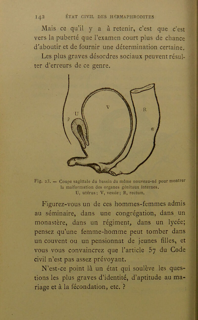 Mais ce qu’il y a à retenir, c’est que c’est vers la puberté que l’examen court plus de chance d^'aboutir et de fournir une détermination certaine. Les plus graves désordres sociaux peuvent résul- ter d’erreurs de ce genre. Fig. 23. — Coupe sagittale du bassin du même nouveau-né pour montrer la malformation des organes génitaux internes. U, utérus; V, vessie; R, rectum. Figurez-vous un de ces hommes-femmes admis au séminaire, dans une congrégation, dans un monastère, dans un régiment, dans un lycée; pensez qu’une femme-homme peut tomber dans un couvent ou un pensionnat de jeunes filles, et vous vous convaincrez que l’article 67 du Gode civil n’est pas assez prévoyant. N’est-ce point là un état qui soulève les ques- tions les plus graves d’identité, d’aptitude au ma- riage et à la fécondation, etc. ?