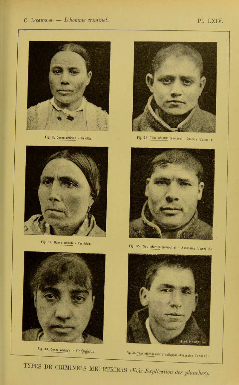 Fig. 31. Donne omlcide - OmicliJa. Fig- 32. Donne omicida - Parricida. Fij. 33. Oo illlii:ii£i£p - Conjugicida, Fig. 34. Tipo infantile (comune.i - Omicida fd'anni 14). FiB- 35. Tipo infantile (imbecllle) ■ Assassino (d'anni Fi0.36.T|po_infantil6 (arr. dl «viluppo) - Assassin 0 (d'anni 23), TYPES DE CRIMINELS MEURTRIERS ^Voir Exph ication des planches).