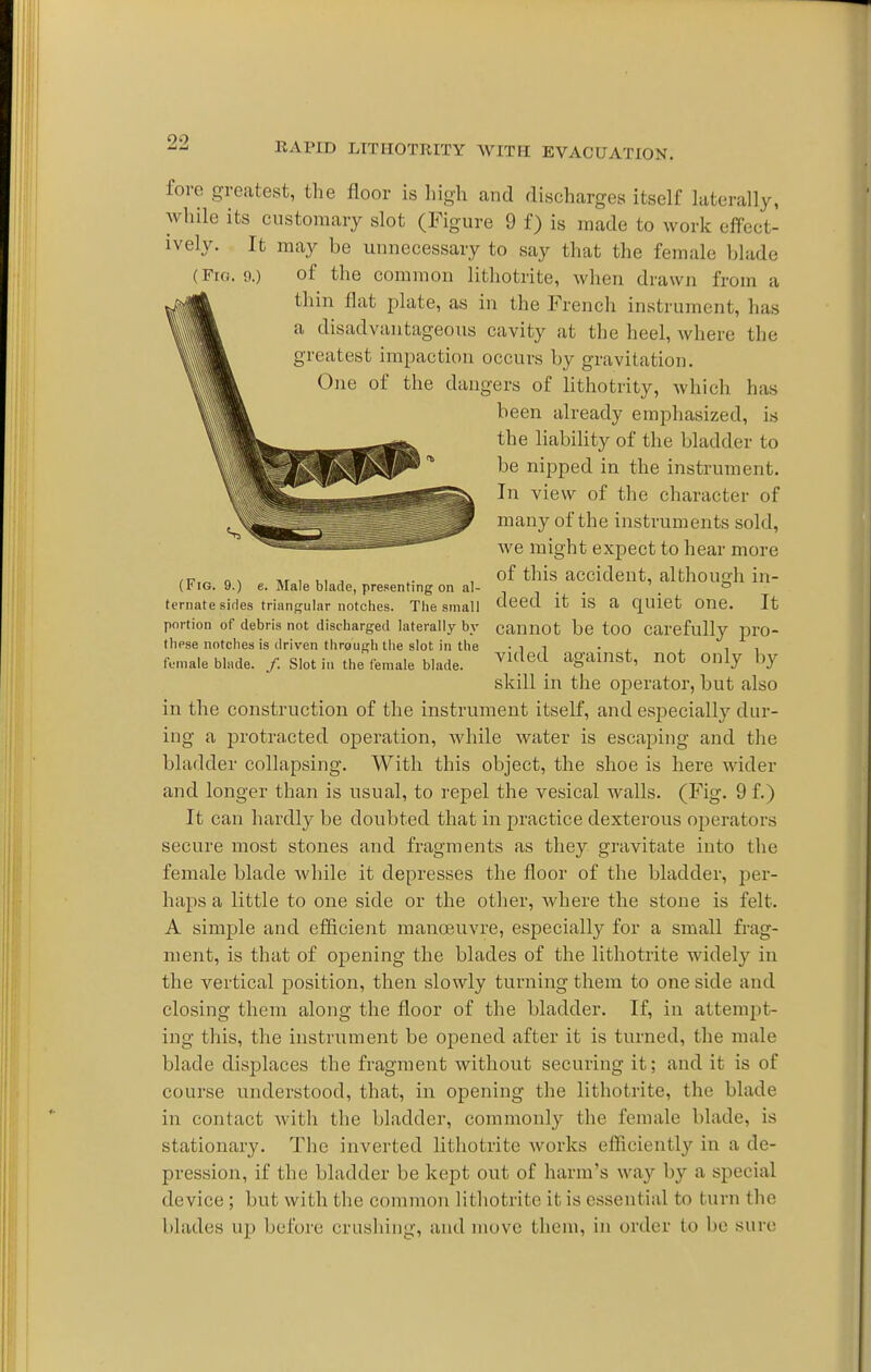 foro greatest, the floor is high and discharges itself laterally, while its customary slot (Figure 9 f) is made to work effect- ively. It may be unnecessary to say that the female blade (Fro. 9.) of the common lithotrite, when drawn from a thin flat plate, as in the French instrument, has a disadvantageous cavity at the heel, where the greatest impaction occurs by gravitation. One of the dangers of lithotrity, which has been already emphasized, is (Fig. 9.) e. Male blade, presenting on al- ternate sirles triangular notclies. The small portion of debris not discharged laterally b)- these notches is driven through the slot in the female blade. /. Slot in the female blade. the liability of the bladder to be nipped in the instrument. In view of the character of many of the instruments sold, we might expect to hear more of this accident, althounh in- deed it is a quiet one. It cannot be too carefully pro- vided against, not only by skill in the operator, but also in the construction of the instrument itself, and especially dur- ing a protracted operation, while water is escaping and the bladder collapsing. With this object, the shoe is here wider and longer than is usual, to repel the vesical walls. (Fig. 9 f.) It can hardly be doubted that in practice dexterous operators secure most stones and fragments as they gravitate into the female blade while it depresses the floor of the bladder, per- haps a little to one side or the other, where the stone is felt. A simple and efficient manoeuvre, especially for a small frag- ment, is that of opening the blades of the lithotrite widely in the vertical position, then slowly turning them to one side and closing them along the floor of the bladder. If, in attempt- ing this, the instrument be opened after it is turned, the male blade displaces the fragment without securing it; and it is of course understood, that, in opening the lithotrite, the blade in contact with the bladder, commonly the female blade, is stationary. The inverted lithotrite works efficiently in a de- pression, if the bladder be kept out of harm's way by a special device ; but with the common lithotrite it is essential to turn the blades up before crushing, and move theni, in order to be sure