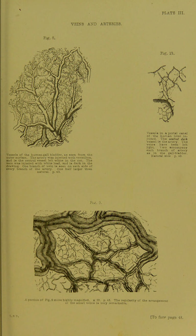 PLAT^l III, VEINS AND ARTERIES. Veaaels of the hutnan-gaU bladder, as seen from the outer surface. The artery was injected with Terroilion, and is the central vessel left wiiite in the cat. The vein was injected with white lead, and is dark in the drawing One branch of vein is seen on each side of every branch of the artery. One half larger than nat^iral. p. 45. Pig. 10. VesRe'is in a portal canal of the human liver in- jt-cted. The central dark vessel is the artery. The veins have been left light. 'I wo accompany each branch of artery as in the gall-bladder. Natural size p. 43. A portion of I'*ig.8 more hiftbly innftninpd. X 20, p. 46. The reftularity of the iirrungement o( the small vfins it* vpry remarkable. [To fncp pa^e 43.