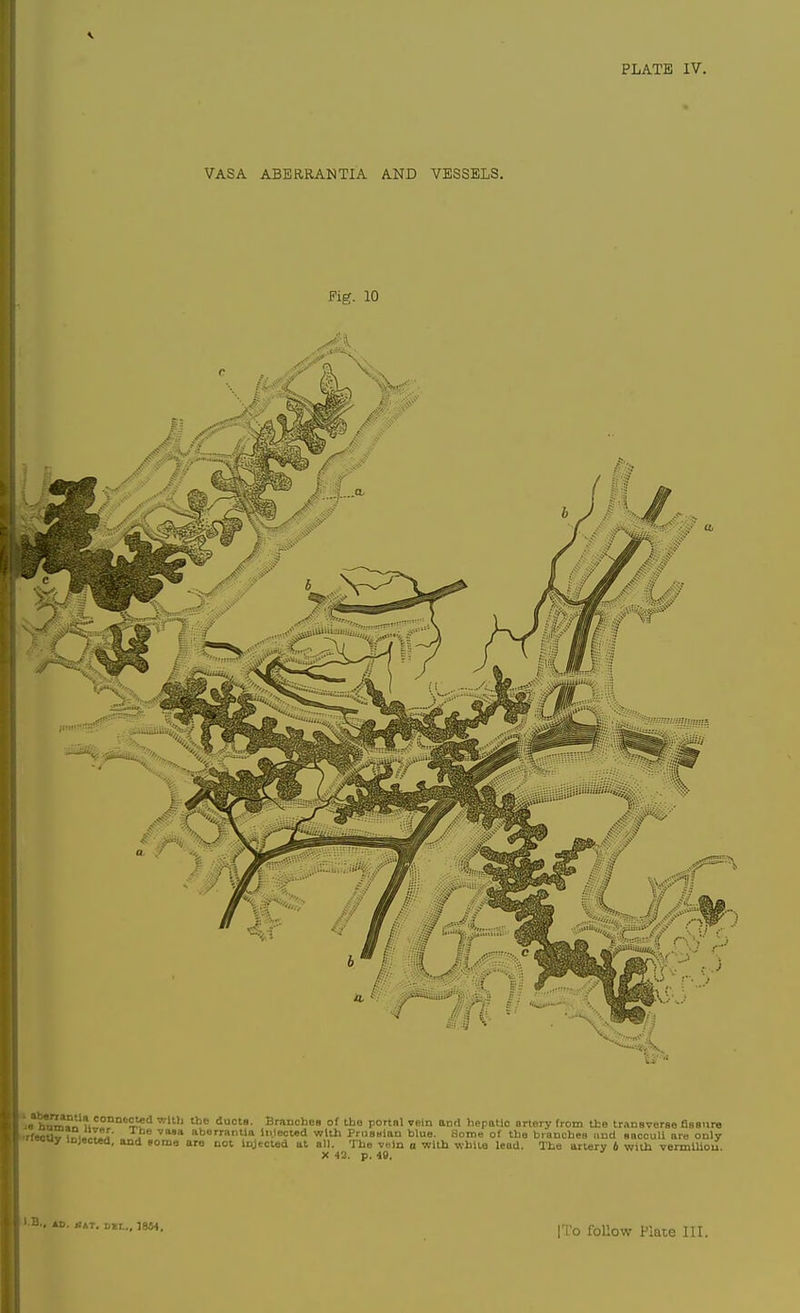 PLATE IV. VASA ABERRANTIA AND VESSELS. Fig. 10 w^^^n ?i^f SJS '^ ducts. Branches of the portal vein and hepatic artery from the transverse assure rfeo^fnuiTri' i* aberranlla li.leoted with PrusHian blue. Some of the branches und saccuU are only »=B«y lojectea, and some are not Icjtcted at all. The voln a -witi white lead. The artery b with vermiUou. X 42. p. 49. l.B, '.. *D. SAT. DEI.., 1884,