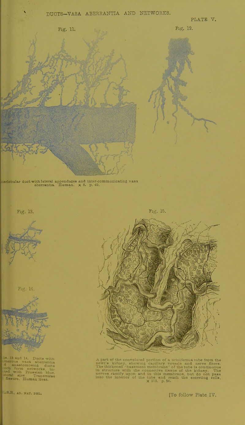 DUCTS—VASA ABERRANTIA AND NETWORKS. Fig. 11. rT'. PLATE V. Fig. 12. lerlobular duct with lateral appendages and inter-commanicating vaaa aberrantia. Human, x 8. p. 49. Fig. 13. Fi. 14. li. 13 sin-i II. Dnctn with rnorO'iB vna ataerriinli^i ^1 aoastomDiintt ducta iich form n-tworks. in- t! wilh Prusilan blii.>. itiiral 8i7s TranBverae uSBare, Human livor. Fig. 15. SKf\ -^''•/fl,. f - A part of thft coDvoluTod portion of .i nmni;.-ioiin iiibe from the uewt'B kiriiicy, sluiwiuii capillm-y vosh^Ih and nerve flbroH. The thickened ' baseTnuut mfinhrune ' of the tube in contiunoiiH in structure with thn ronnoctlve UHsue of the kidooy. The nerves ramify up.^n and in thin membraoo. but do not paB» Into the interior of the tube and reach the socretlng coUb, X 215. p. nu ■'.3.B., AD. NAT. DEI,.