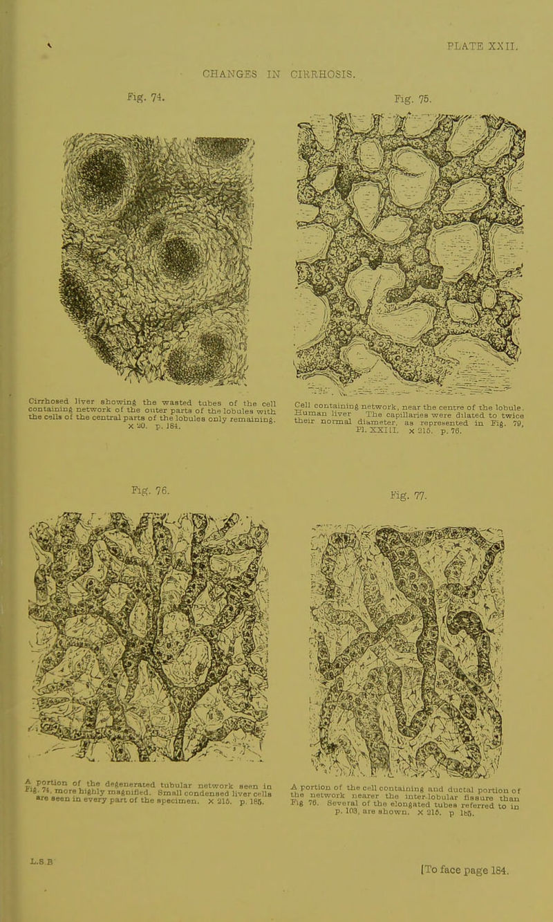 CHANGES IN CIRRHOSIS. L.S B