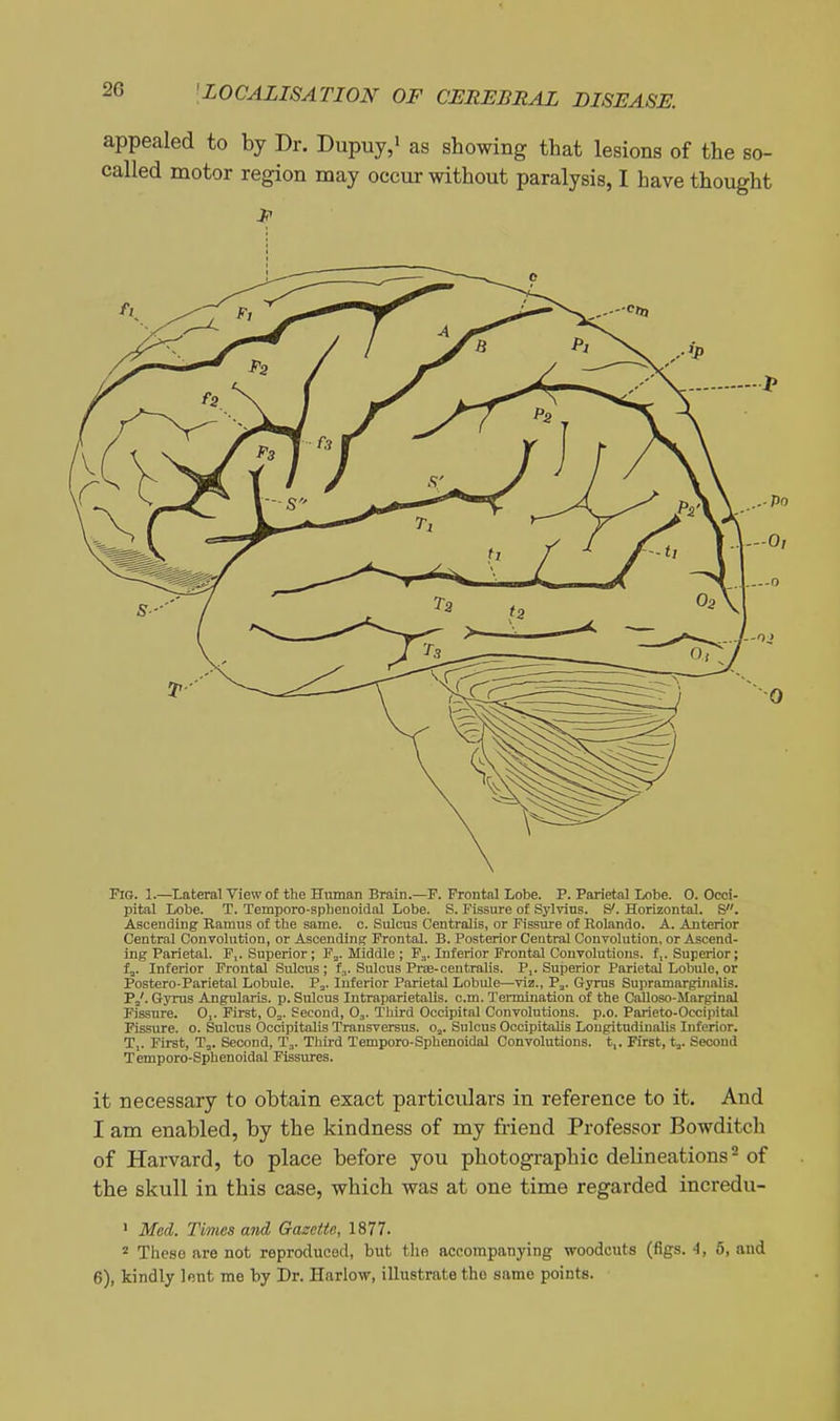 appealed to by Dr. Dupuy,' as showing that lesions of the so- called motor region may occur without paralysis, I have thought Fig. 1.—Lateral View of the Hitman Brain.—F. Frontal Lobe. P. Parietal Lobe. 0. Occi- pital Lobe. T. Temporo-spbenoidal Lobe. S. Fissure of Sylvius. S*. Horizontal. S. Ascending Ramus of the same. c. Sulcus Centralis, or Fissure of Rolando. A. Anterior Central Convolution, or Ascending Frontal. B. Posterior Central Convolution, or Ascend- ing Parietal. P,. Superior; F^. Middle ; Pj. Inferior Frontal Convolutions, f,. Superior; fj. Inferior Frontal Sulcus ; f,. Sulcus Prse-centraUs. P,. Sujjerior Parietal Lobule, or Postero-Parietal Lobule. P^. Inferior Parietal Lobule—viz., P^. Gyrus Supramarginalis. P3'. Gyrus Angularis. p. Sulcus Intraparietalis. cm. Termination of the Calloso-Marginal Fissure. 0,. First, Oj. Second, O3. Third Occipital Convolutions, p.o. Parieto-Occipital Fissure, o. Sulcus Occipitalis Transversus. o^. Sulcus Occipitalis Lougitndinalis Inferior. T,. First, Ta. Second, Tj. Third Temporo-Sphenoidal Convolutions, t,. First, t,. Second Temporo-Spbenoidal Fissures. it necessary to obtain exact particulars in reference to it. And I am enabled, by the kindness of my friend Professor Bowditch of Harvard, to place before you photographic delineations ^ of the skull in this case, which was at one time regarded incredu- ' Med. Times and Gazette, 1877. 2 These are not reproduced, but tlie accompanying woodcuts (figs. A, 5, and 6), kindly lent me by Dr. Harlow, illustrate the same points.