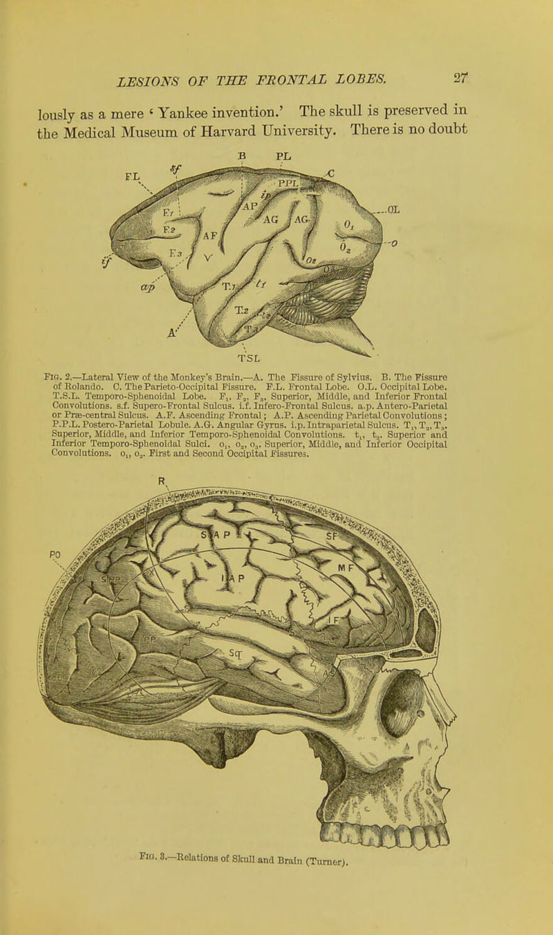 lously as a mere ' Yankee invention.' The skull is preserved in the Medical Museum of Harvard University. There is no doubt B PL Fio. 2.—Lateral View of the Monkey's Brain.—A. Tlie Fissure of Sylvius. B. The Fissure of Rolando. C. The Parieto-Occipital Fissure. F.L. Frontal Lobe. O.L. Occipital Lobe. T.S.L. Temporo-Sphenoidal Lobe. F,, F„, F,, Superior, Middle, and Inferior Frontal Convolutions, s.f. Supero-Frontal Sulcus, i.f. Infero-Frontal Sulcus, a.p. Antero-Parietal or Prffi-central Sulcus. A.F. Ascending Frontal; A.P. Ascending Parietal Convolutions ; P.P.L. Postero-Parietal Lobule. A.G-. Angular Gyrus. i.p.Intraparietal Sulcus. T„Ti„T;,. Superior, Middle, and Inferior Temporo-Sphenoidal Convolutions. t„ t^. Superior and Inferior Temporo-Sphenoidal Sulci, o,, o,, O3. Superior, Middle, and Inferior Occipital Convolutions. o„ O3. First and Second Occipital Fissures. I. 8.—Relations of Skull and Brain (Turner).
