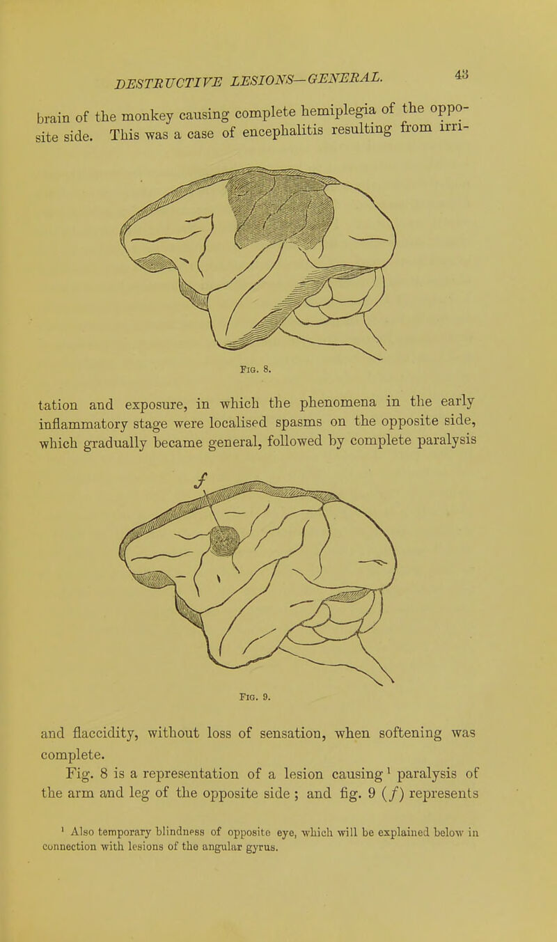 brain of the monkey causing complete hemiplegia of the oppo- site side. This was a case of encephalitis resulting from irri- Fig. 8. tation and exposure, in which the phenomena in the early- inflammatory stage were localised spasms on the opposite side, which gradually became general, followed by complete paralysis Fig. 9. and flaccidity, without loss of sensation, when softening was complete. Fig. 8 is a representation of a lesion causing' paralysis of the arm and leg of the opposite side ; and fig. 9 (/) represents ' Also temporary blindness of opposite eye, which will be explained below in connection with lesions of the angular gyrus.