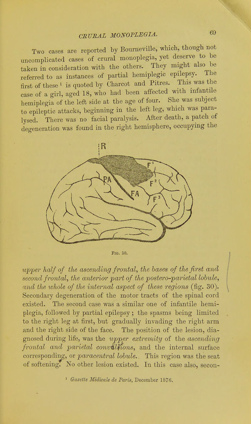 Two cases are reported by Bourneville, which, though not uncomplicated cases of crural monoplegia, yet deserve to be taken in consideration with the others. They might also be referred to as instances of partial hemiplegic epilepsy. The first of these ' is quoted by Charcot and Pitres. This was the case of a girl, aged 18, who had been affected with infantile hemiplegia of the left side at the age of four. She was subject to epileptic attacks, beginning in the left leg, which was para- lysed. There was no facial paralysis. After death, a patch of degeneration was found in the right hemisphere, occupying the iR Fig. 30. upper half of the ascending frontal, the bases of the first and second frontal, the anterior part of the postero-parietal lobule, and the ivhole of the internal aspect of these regions (fig. 30). Secondary degeneration of the motor tracts of the spinal cord existed. The second case was a similar one of infantile hemi- plegia, followed by partial epilepsy ; the spasms being limited to the right leg at first, but gradually invading the right arm and the right side of the face. The position of the lesion, dia- gnosed during life, was the upper extremity of the ascending frontal and parietal conv&Uions, and the internal surface corresponding, or paracentral lobule. This region was the seat of softening. No other lesion existed. In this case also, secon- ' Gazette Midicale de Faris, Decembei- 187(5.