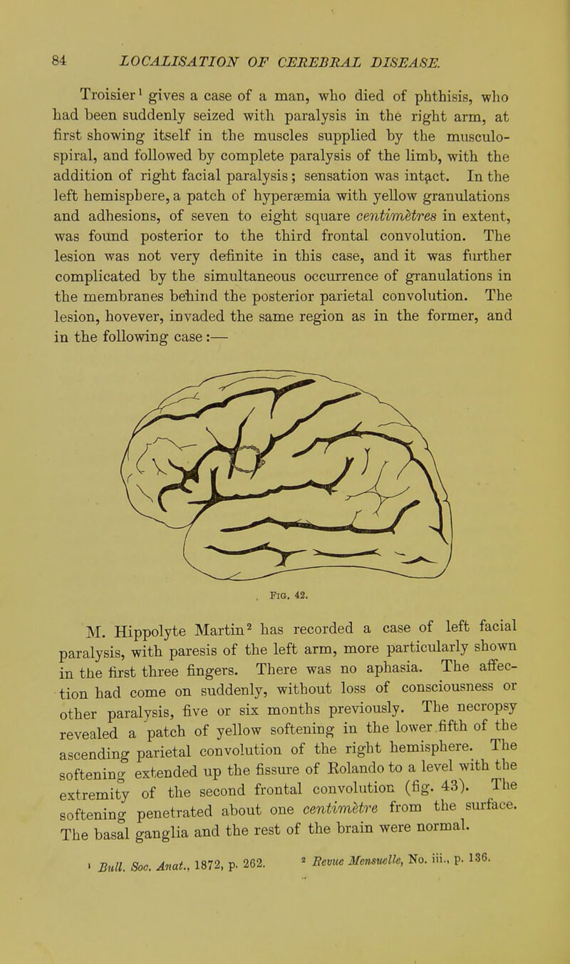 Troisier' gives a case of a man, who died of phthisis, wlio had been suddenly seized witli paralysis in the right arm, at first showing itself in the muscles supplied by the musculo- spiral, and followed by complete paralysis of the limb, with the addition of right facial paralysis; sensation was intact. In the left hemisphere, a patch of hypersemia with yellow granvilations and adhesions, of seven to eight square centimetres in extent, was found posterior to the third frontal convolution. The lesion was not very definite in this case, and it was further complicated by the simultaneous occurrence of granulations in the membranes behind the posterior parietal convolution. The lesion, hovever, invaded the same region as in the former, and in the following case:— Fig. 42. M. Hippolyte Martin ^ has recorded a case of left facial paralysis, with paresis of the left arm, more particularly shown in the first three fingers. There was no aphasia. The affec- tion had come on suddenly, without loss of consciousness or other paralysis, five or six months previously. The necropsy revealed a patch of yellow softening in the lower .fifth of the ascending parietal convolution of the right hemisphere. The softening extended up the fissm-e of Eolando to a level with the extremity of the second frontal convolution (fig. 43). The softening penetrated about one centimetre from the surface. The basal ganglia and the rest of the brain were normal. I Bull. 8oc. Anat.. 1872, p. 262. ^ Bevuc MenswUe, No. iii.. p. 136.