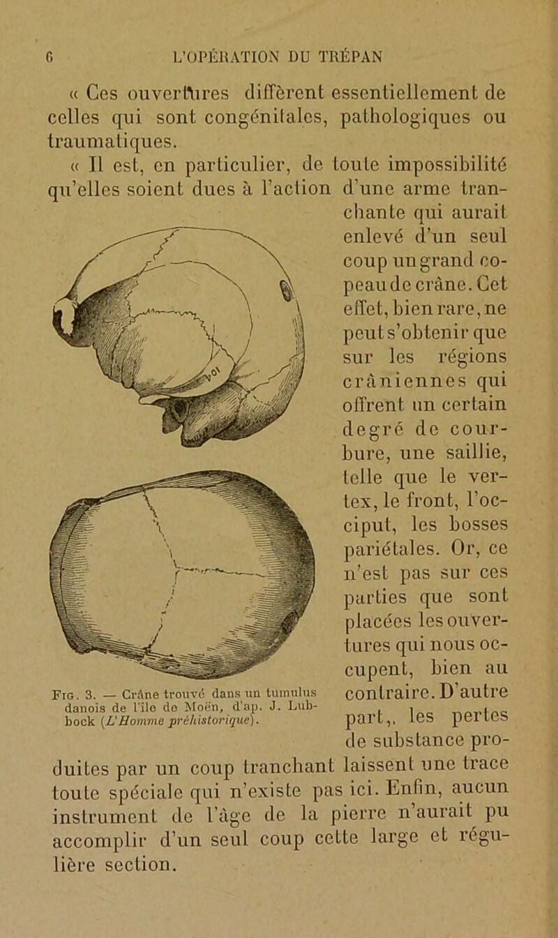 « Ces ouvertures diffèrent essentiellement de celles qui sont congénilalcs, pathologiques ou traumatiques. « Il est, en particulier, de toute impossibilité qu’elles soient dues à l’action d’une arme tran- chante qui aurait enlevé d’un seul coup un grand co- peau de crâne. Cet effet, bien rare, ne peut s’obtenir que sur les régions crâniennes qui offrent un certain degré de cour- bure, une saillie, telle que le ver- tex, le front, l’oc- ciput, les bosses pariétales. Or, ce n’est pas sur ces parties que sont placées les ouver- tures qui nous oc- cupent, bien au contraire. D’autre part,, les pertes de substance pro- duites par un coup tranchant laissent une trace toute spéciale qui n’existe pas ici. Enfin, aucun instrument de l’âge de la pierre n aurait pu accomplir d’un seul coup cette large et régu- lière section. Fig. 3. — Crâne trouvé dans un tumulus danois de l’ilo do Moèn, d'ap. J. Lub- bock (L'Homme préhistorique).