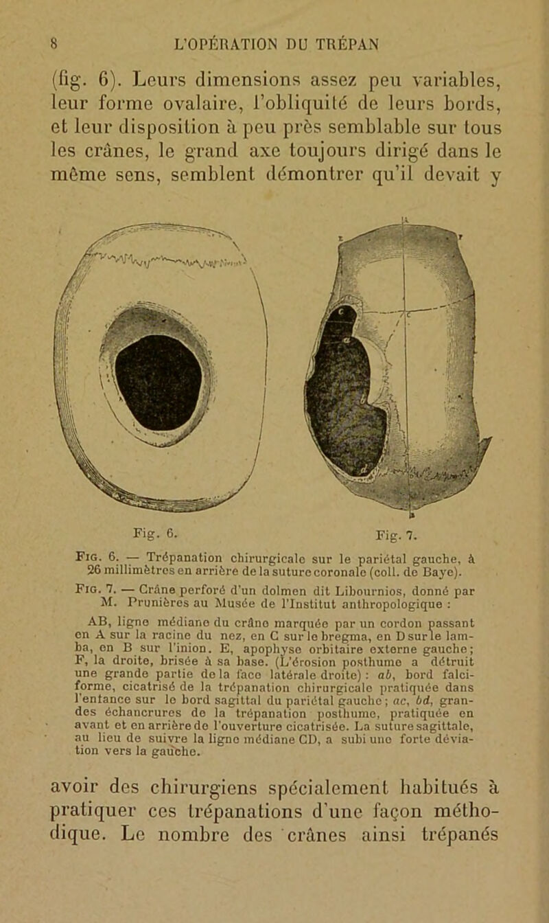 (fig. 6). Leurs dimensions assez peu variables, leur forme ovalaire, i’obliquilé de leurs bords, et leur disposition à peu près semblable sur tous les crânes, le grand axe toujours dirigé dans le môme sens, semblent démontrer qu’il devait y Fig- 6. Fig. 7. Fig. 6. — Trépanation chirurgicale sur le pariétal gauche, à 26 millimètres en arrière de la suture coronale (coll. de Baye). Fig. 7. — Crâne perforé d’un dolmen dit Libournios, donné par M. Prunières au Musée de l’Institut anthropologique : AB, ligne médiane du crâno marquée par un cordon passant on A sur la racine du nez, en C sur le bregma, en Dsurle lam- ba, en B sur l'inion. E, apophyso orbitaire externe gauche; F, la droite, brisée â sa base. (L’érosion posthume a détruit une grande partie delà lace latérale droite) : ab, bord falci- forme, cicatrisé de la trépanation chirurgicale pratiquée dans l’entance sur le bord sagittal du pariétal gauche; ac, bd, gran- des échancrures do la trépanation posthume, pratiquée en avant et en arrière do l’ouverture cicatrisée. La suture sagittale, au lieu de suivre la ligno médiane CD, a subi une forte dévia- tion vers la gauche. avoir des chirurgiens spécialement habitués à pratiquer ces trépanations d une façon métho- dique. Le nombre des crânes ainsi trépanés