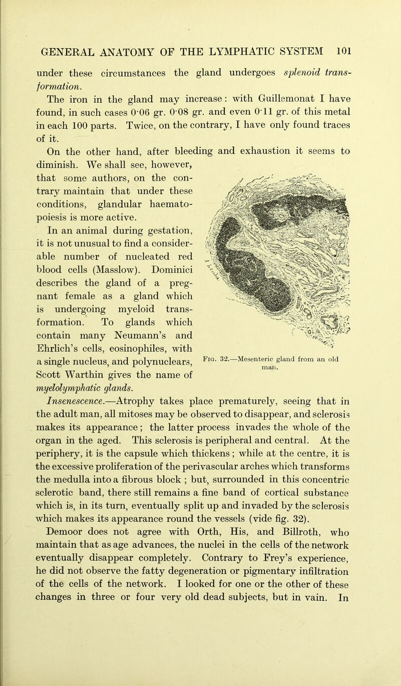 under these circumstances the gland undergoes splenoid trans- formation. The iron in the gland may increase : with Guillemonat I have found, in such cases 006 gr. 0'08 gr. and even 0T1 gr. of this metal in each 100 parts. Twice, on the contrary, I have only found traces of it. On the other hand, after bleeding and exhaustion it seems to diminish. We shall see, however, that some authors, on the con- trary maintain that under these conditions, glandular haemato- poiesis is more active. In an animal during gestation, it is not unusual to find a consider- able number of nucleated red blood cells (Masslow). Dominici describes the gland of a preg- nant female as a gland which is undergoing myeloid trans- formation. To glands which contain many Neumann’s and Ehrlich’s cells, eosinophiles, with a single nucleus, and polynuclears, Scott Warthin gives the name of mydolymphatic glands. Insenescence.—Atrophy takes place prematurely, seeing that in the adult man, all mitoses may be observed to disappear, and sclerosis makes its appearance ; the latter process invades the whole of the organ in the aged. This sclerosis is peripheral and central. At the periphery, it is the capsule which thickens ; while at the centre, it is the excessive proliferation of the perivascular arches which transforms the medulla into a fibrous block ; but, surrounded in this concentric sclerotic band, there still remains a fine band of cortical substance which is, in its turn, eventually split up and invaded by the sclerosis which makes its appearance round the vessels (vide fig. 32). Demoor does not agree with Orth, His, and Billroth, who maintain that as age advances, the nuclei in the cells of the network eventually disappear completely. Contrary to Frey’s experience, he did not observe the fatty degeneration or pigmentary infiltration of the cells of the network. I looked for one or the other of these changes in three or four very old dead subjects, but in vain. In <-:V Fig. 32.—Mesenteric gland from an old man.